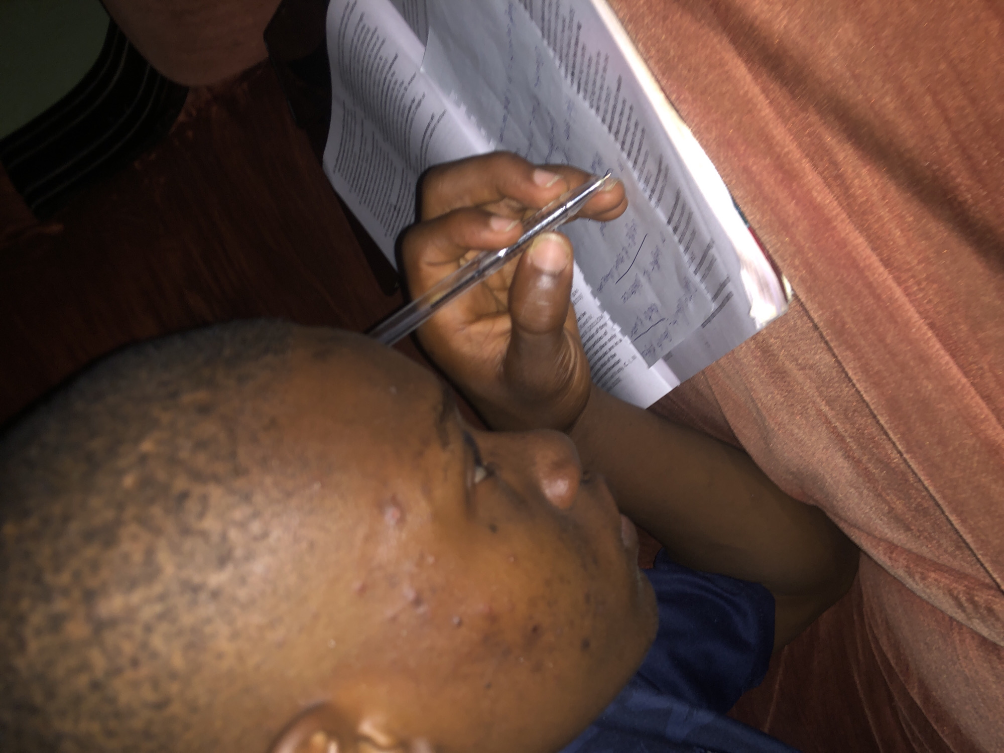 A person lies on a brown plush surface, possibly a couch or bed. The person has dark skin, a shaved head, and acne scarring on their face. They are wearing a dark blue shirt. The person's right hand holds a clear pen above a stack of papers with handwritten text. The background is out of focus, but suggests a residential indoor setting. There is no information in the image to confirm the location of Atani, Nigeria.