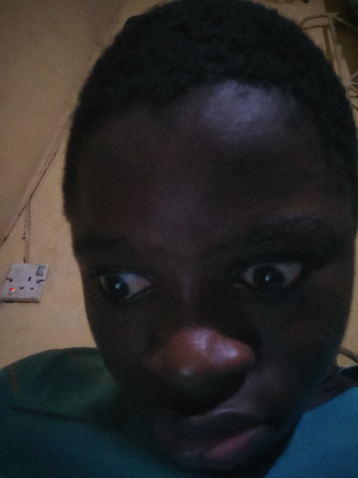 A close-up image shows a person with dark skin. The person has short, dark hair, wide eyes, and a large nose. The person is wearing a green or blue shirt. The background is a yellow wall with an electrical outlet. The location is Unknown, Unknown.