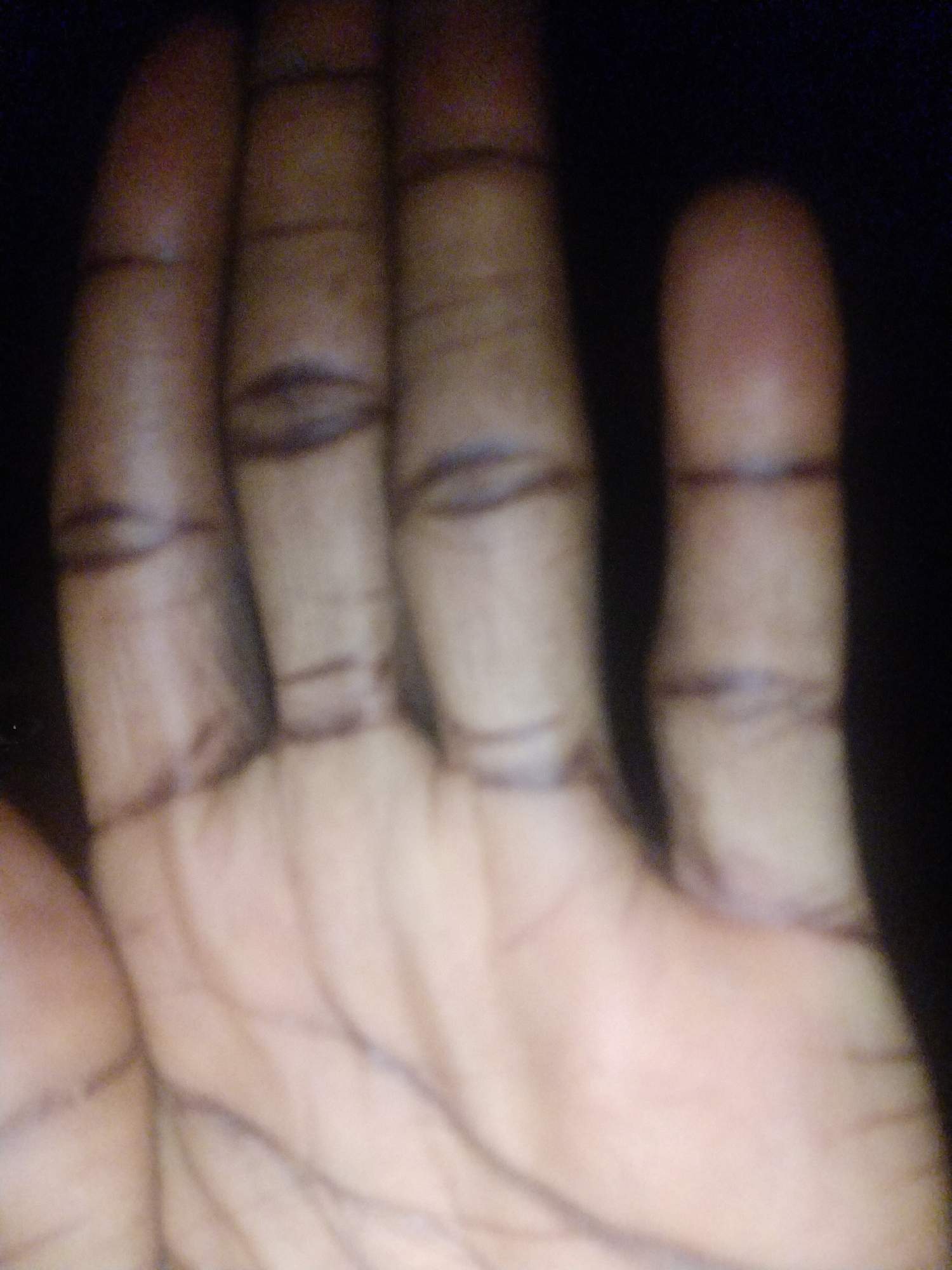 An image of a human hand, palm up, with dark lines drawn across the fingers at each joint. The skin tone appears to be dark brown or black. The photo quality is poor and the focus is soft, obscuring fine details. There is no visible background to provide context for location. The location cannot be determined.