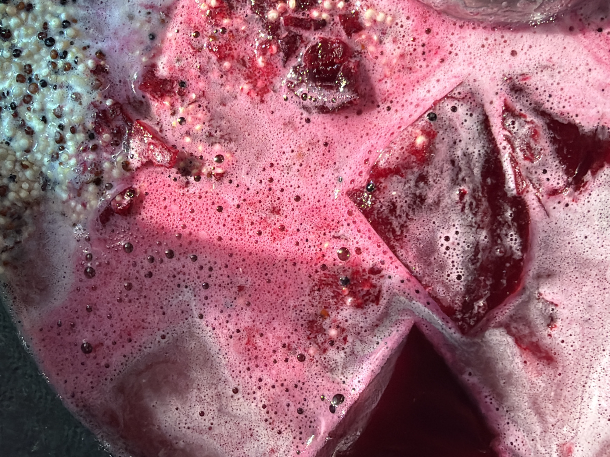 The image presents a high-angle, close-up view of a vibrant, frothy mixture of food ingredients. The primary subject is a lively pink to magenta liquid, heavily aerated and covered with countless small bubbles, giving it a foamy appearance. Within this effervescent pink liquid are several dark red, irregular, chunky pieces, which resemble diced fruit or vegetables, possibly beetroot or berries, contributing to the rich color of the liquid.
On the upper left side of the frame, there is a distinct area showcasing a granular texture. This section contains numerous small, off-white or light beige spheres, interspersed with smaller, dark brown or black seeds. This granular component strongly suggests the presence of cooked quinoa mixed with other seeds, such as chia or poppy seeds. These grains are visibly integrating with the pink foamy liquid, indicating they are part of the same preparation.
The activity depicted is likely the mixing, cooking, or blending of these ingredients, possibly for a dish, smoothie, or preserve. The presence of foam suggests agitation or heat. The mixture appears contained within a vessel, with glimpses of a darker, possibly metallic or deep red surface visible along the bottom and right edges of the frame. The lighting creates bright highlights on the bubbles and liquid surface. No people or visible text are present in the image. The scene suggests a culinary process, possibly in a kitchen environment.