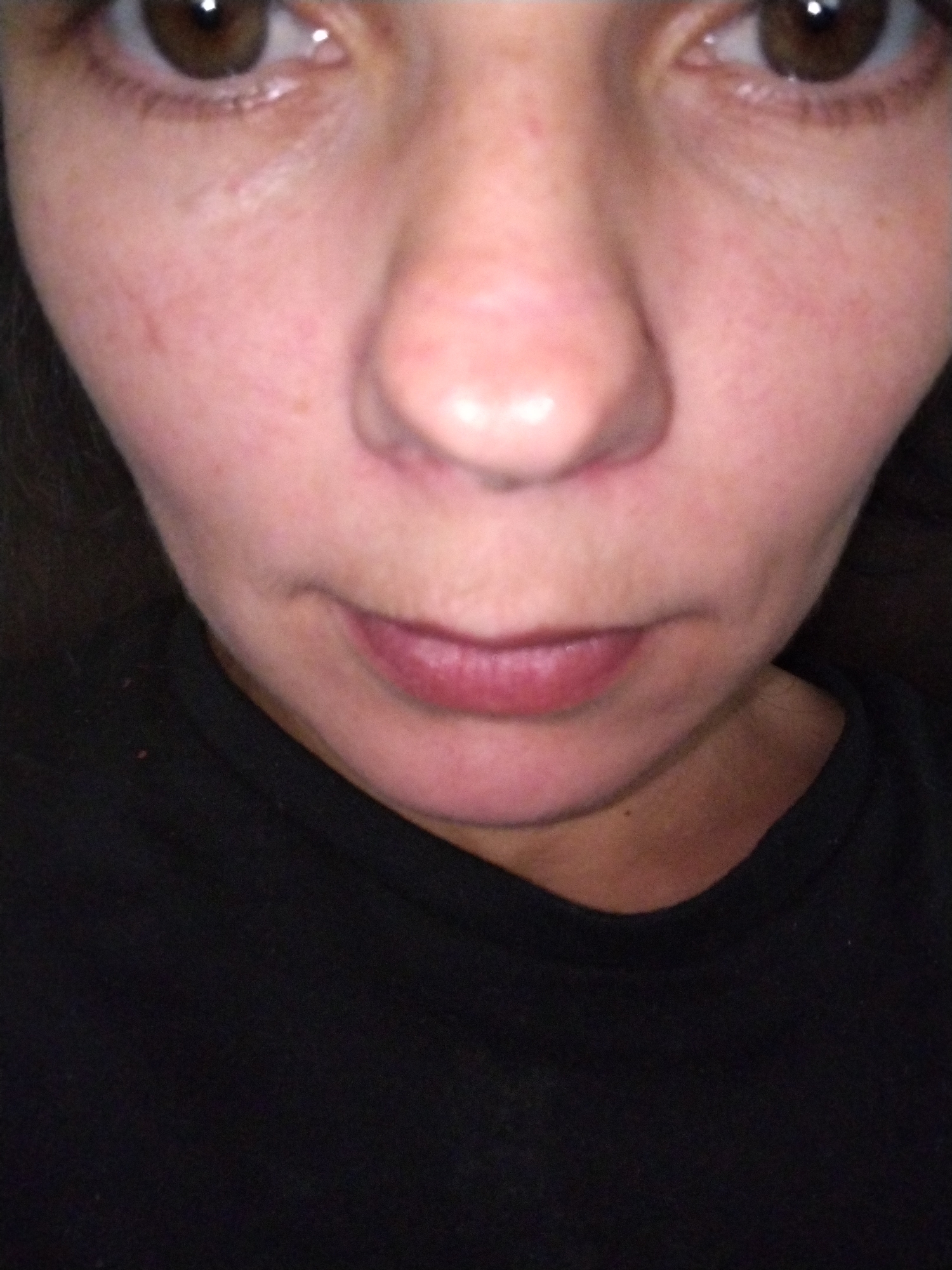 This is a close-up, low-angle, headshot photograph of a person's face, focusing on the eyes, nose, and mouth, with a portion of their black t-shirt visible at the bottom. The lighting is somewhat harsh and appears to be from above. The person has brown eyes, and their skin tone is fair with some reddish undertones. There are faint marks on the cheeks. The image appears to be taken indoors, and there is no discernible context of the city of Molodiia, Ukraine, within the frame.