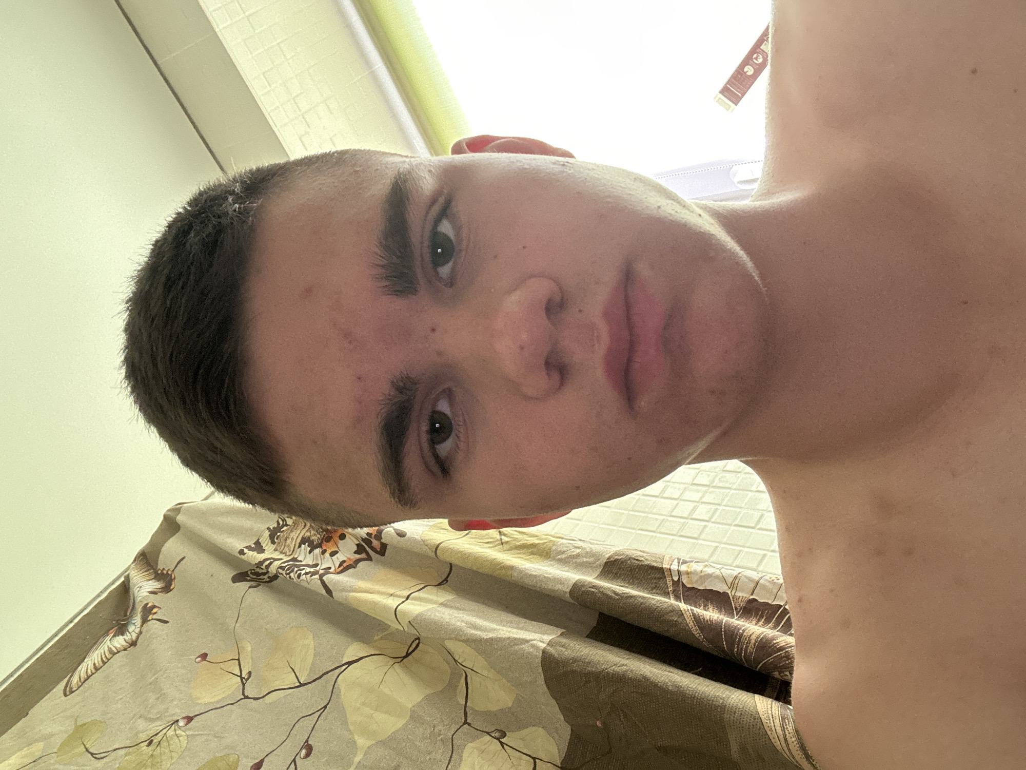 A young male with a serious expression is the subject of this head-and-shoulders selfie. He has short, dark hair and prominent eyebrows. His skin has some redness and minor blemishes, particularly on his forehead and cheeks. He is looking directly at the camera. Behind him, a shower curtain with a floral and butterfly pattern is visible. The background appears to be a tiled wall, and a bright light source is to his right. A small object with red markings is partially visible in the upper right corner of the frame. The scene is indoors, likely in a bathroom.