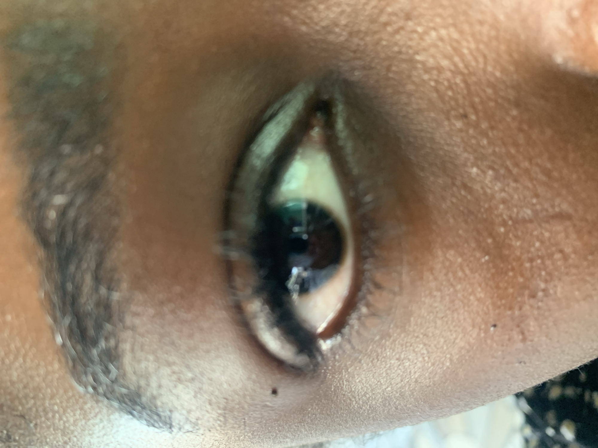The image presents an extremely close-up, tilted view of a human eye, belonging to a person with brown skin. The setting appears to be indoors, indicated by reflections in the pupil that suggest artificial light sources or screens.
The eye itself features a dark brown or black iris and a prominent pupil. Distinct reflections, including a bright white highlight and a subtle greenish-blue tint, are visible within the pupil, implying an interaction with a digital screen or specific indoor lighting. Dark eyelashes are visible along both the upper and lower eyelids. The skin immediately surrounding the eye displays natural texture and visible pores. A small, dark mole or freckle is clearly present below the center of the lower eyelid. Part of a dark, well-defined eyebrow is visible in the upper left portion of the frame, slightly out of focus.
The image is captured at an angle, giving the impression that the person's head was tilted. There is no discernible activity taking place, only a static, detailed view of the eye. No text is visible in the media file. The image exhibits a slight blur, which might be due to a shallow depth of field or minor movement during capture. Given the context, the person is likely in Jos, Nigeria.