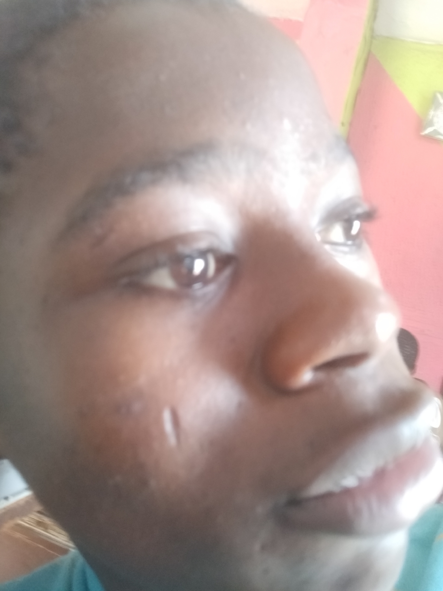 A close-up shot of a Black person's face. The subject is facing towards the right side of the frame, with focus on the eyes, nose, and mouth. The skin appears to be smooth. A small linear scar is visible on the cheek. The background is a blurred combination of pink, green, and white. There is no information about the location in Shangisha, Nigeria or specifics of subjects, objects, actions or interactions in the environment.
