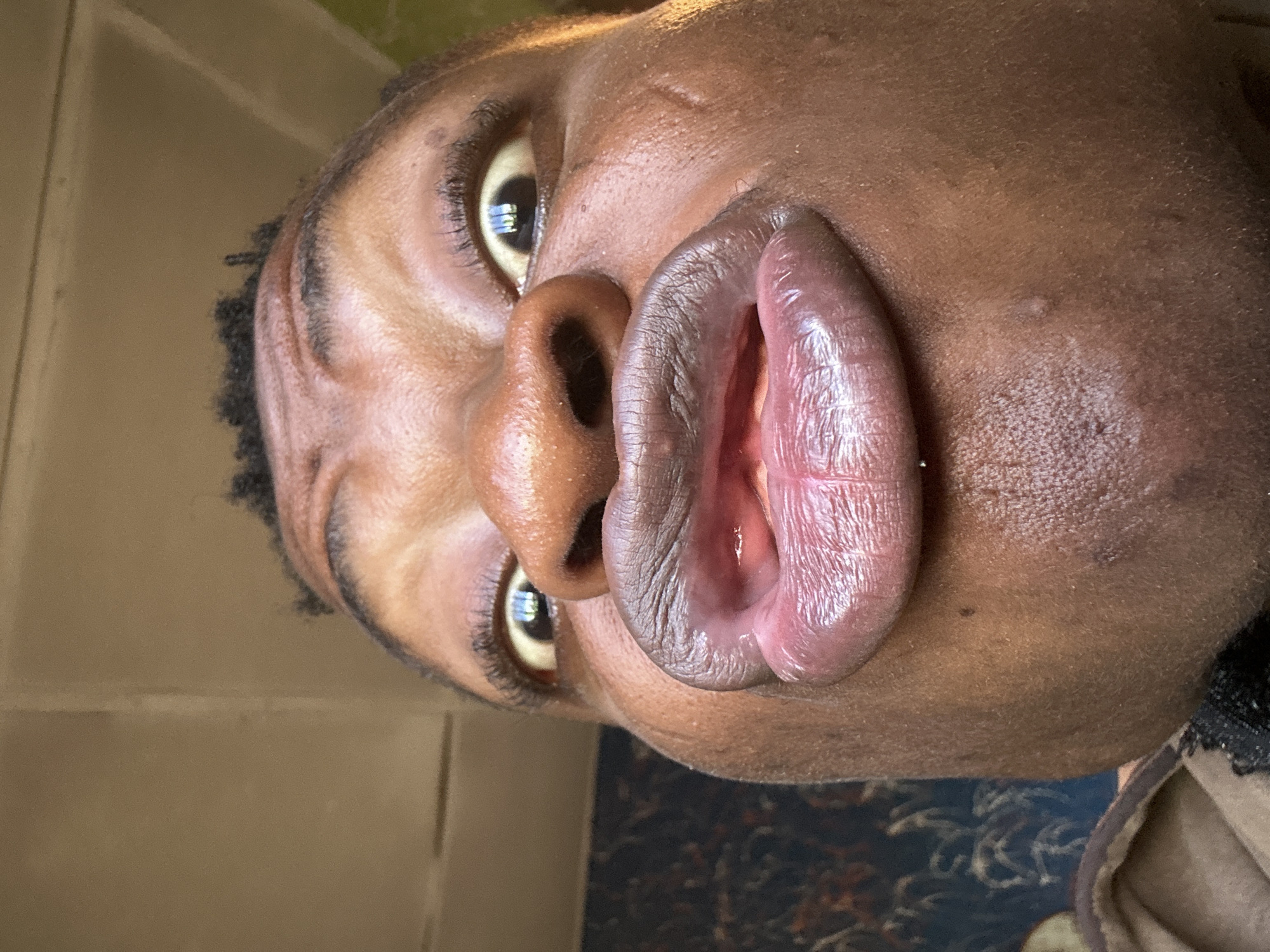 A close-up, upward-angled portrait of a dark-skinned person with full lips. The person's eyes are visible, and there are short, dark hairs along the hairline. The environment is unclear but appears to be indoors. The location is Unknown, Unknown.