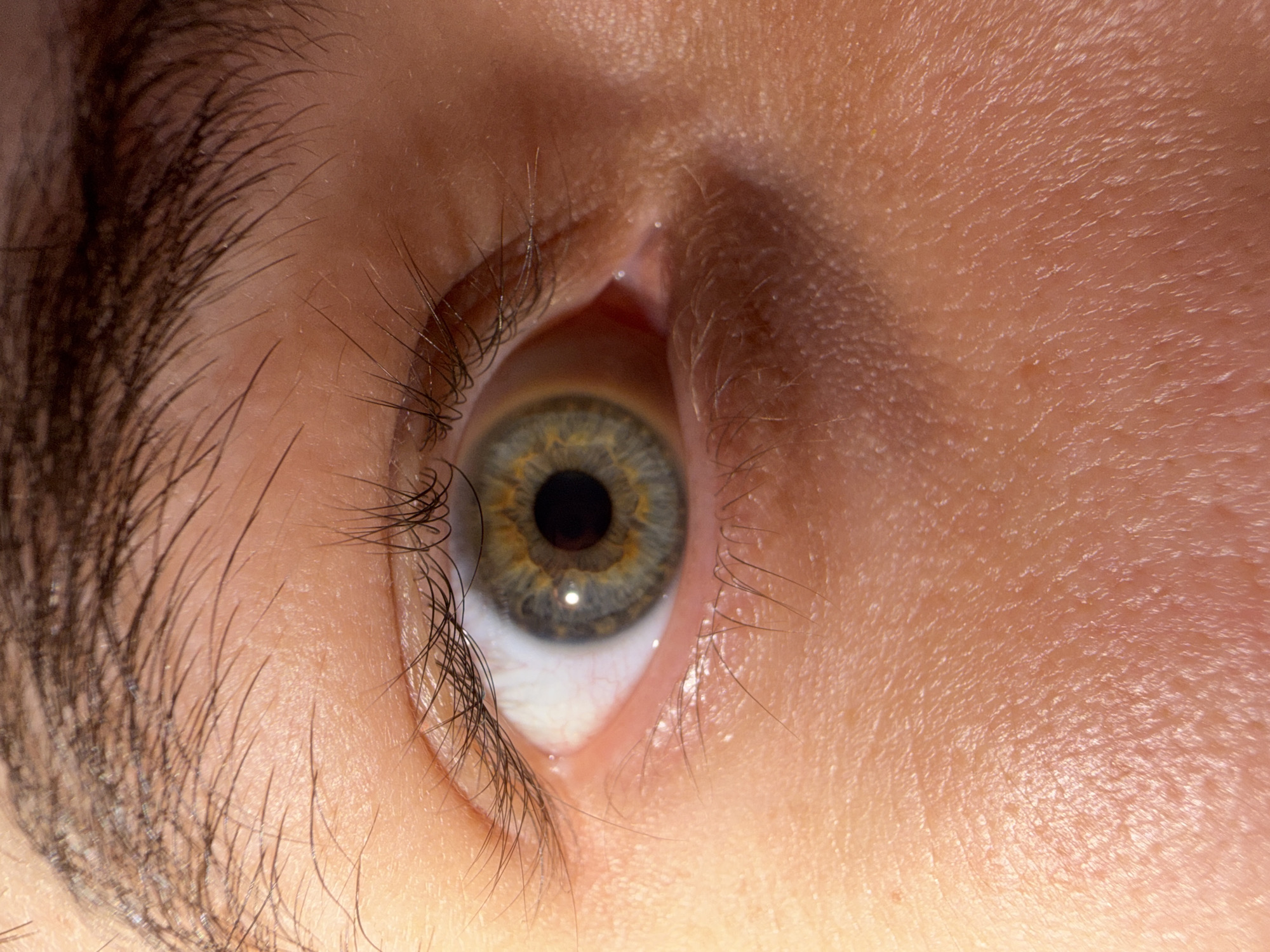 The image is an extreme close-up of a human eye and surrounding skin. The eye is open, revealing a green and brown iris with a black pupil. Eyelashes are visible along the upper and lower eyelids. The skin appears slightly textured and has a warm tone. No location in Bangkok, Thailand is depicted in this image.