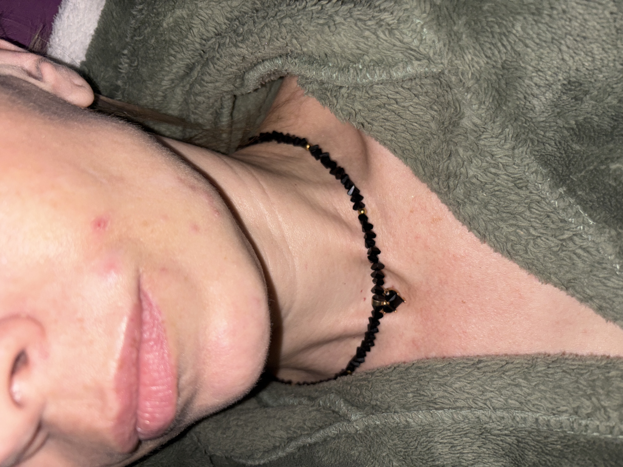 The image presents a close-up, angled shot of a person, likely indoors in an unknown location in Russia. The subject's face is partially visible on the left, showing their nose, chin, a slightly parted mouth with pink lips, and a section of their cheek. The skin exhibits visible freckles and a few small red blemishes. A strand of dark hair can be seen near the ear.
The central focus is on the person's neck, adorned with a black beaded choker-style necklace. The necklace features small, irregular black beads interspersed with tiny gold accents, and a distinctive small black heart-shaped charm positioned at the front.
A thick, fuzzy, greyish-green fabric, appearing to be a blanket, robe, or similar soft garment, occupies the right side of the frame and extends around the person's neck and shoulder. The lighting is dim and artificial, suggesting an indoor setting, possibly at night or in low light. The person appears to be resting or lying down, conveying a calm and relaxed demeanor. No specific activity beyond resting is discernible, and there is no visible text in the image.