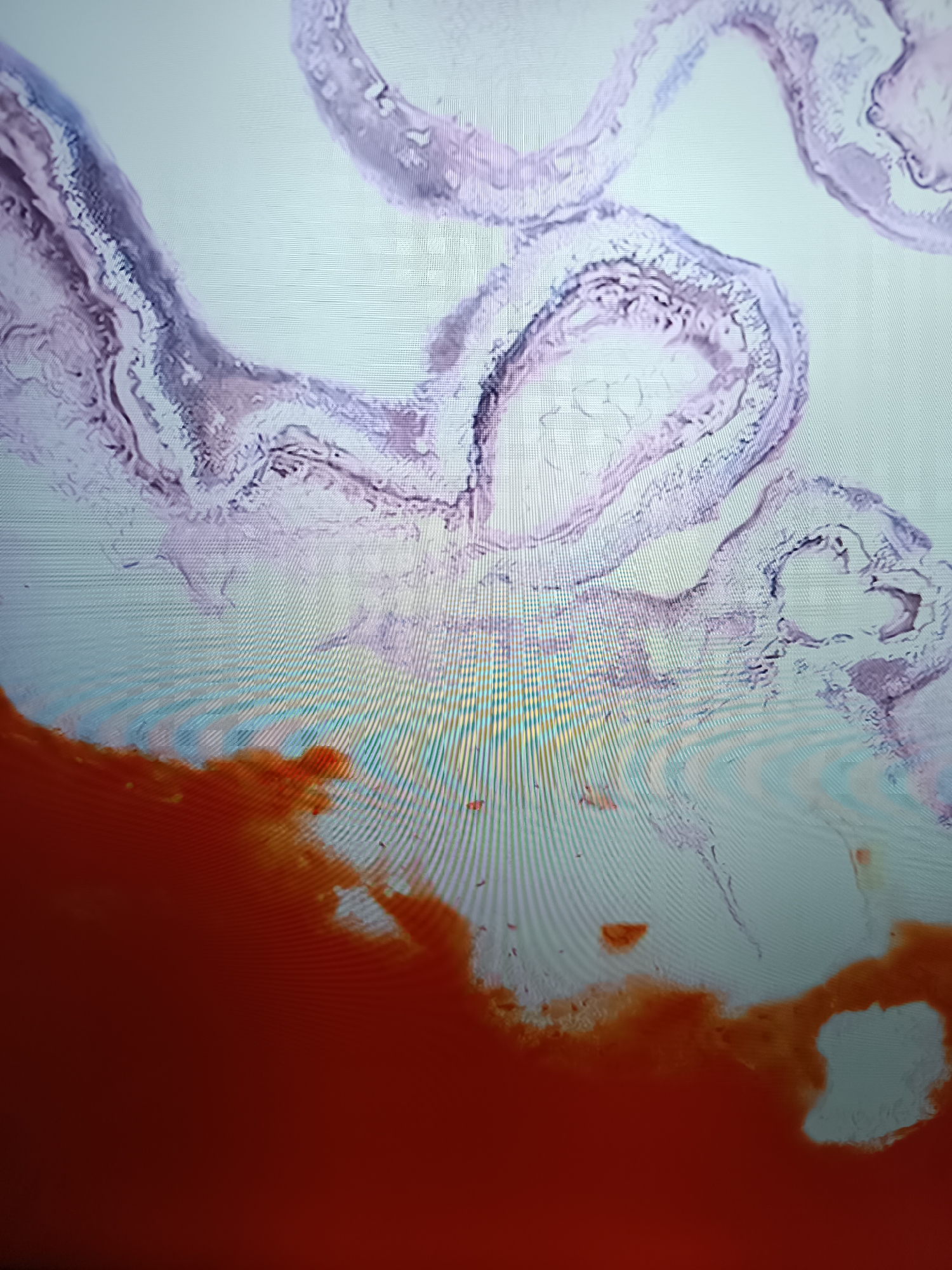 The image displays a microscopic view of biological tissue, likely stained for histological examination. The upper portion of the image reveals layered structures with purple and pink hues, possibly representing cellular or tissue components. These layers are folded and irregular in shape. The lower portion of the image is dominated by a large, amorphous mass of bright orange-red color, which could be a staining artifact, a specific type of biological substance, or a medium used for slide preparation. The overall impression is that of a prepared slide viewed under a microscope, rather than a scene within the city of Taraz, Kazakhstan. There are no discernible elements that would allow for identification of a specific location or context within the city.