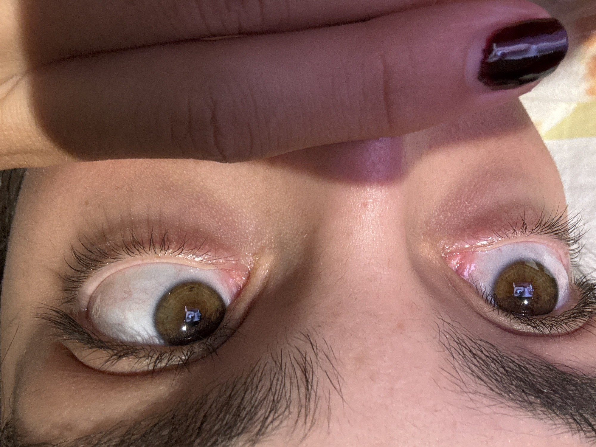 The image shows a close-up view of a person's face from a low angle. The person's eyes are looking upward, with brown irises reflecting a screen. The person's eyebrow is visible. A hand is partially obscuring the forehead. The fingernail is painted dark purple. The image does not include any information pertaining to Mata de Uva, Mexico.