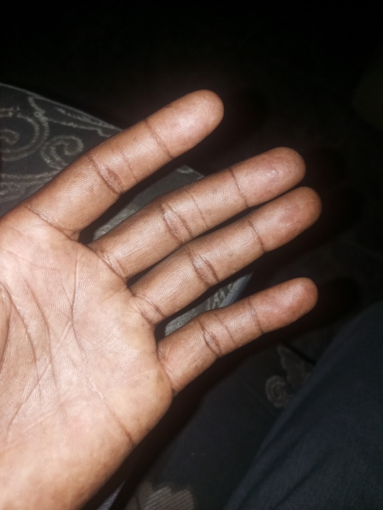 A close-up, low-angle shot shows a person's left hand and palm, with fingers extended and slightly curled. The skin tone is a medium brown, with visible lines and creases on the palm and across the knuckles and segments of the fingers. The fingertips show distinct fingerprint patterns. The background is dark, with the suggestion of fabric textured with a swirling pattern, likely a textile like upholstery or clothing. A small portion of dark fabric is visible to the right of the hand. The lighting is dim, casting some shadows. The image is taken in Gombe, Nigeria.