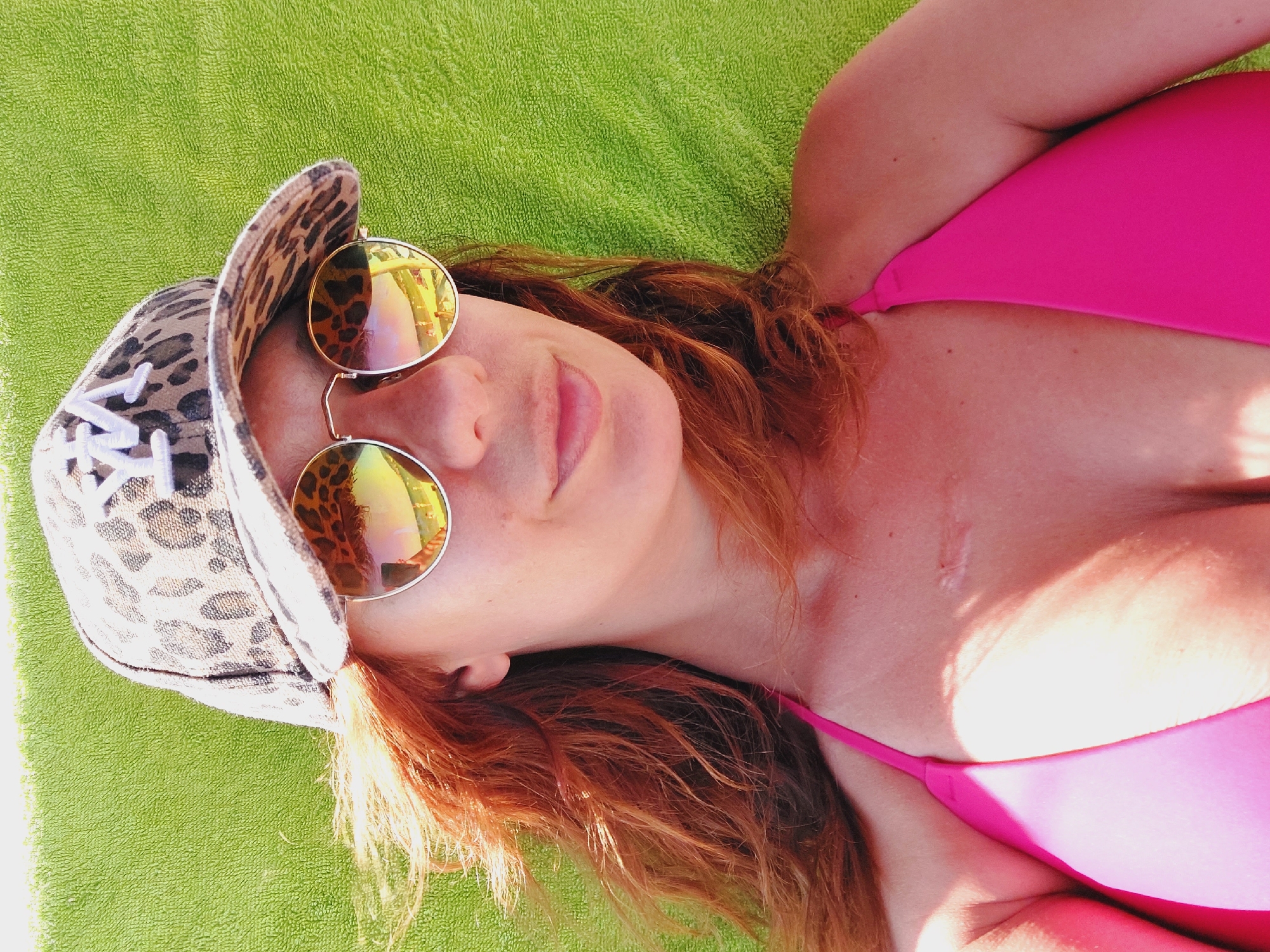 In Sozopol, Bulgaria, a woman with auburn hair lies on a vibrant green towel. She is wearing a bright pink bikini top and a leopard-print baseball cap with white lettering that appears to read "NY". Her face is partially obscured by round, mirrored sunglasses with gold frames, reflecting a beach scene with people. A scar is visible on her collarbone.