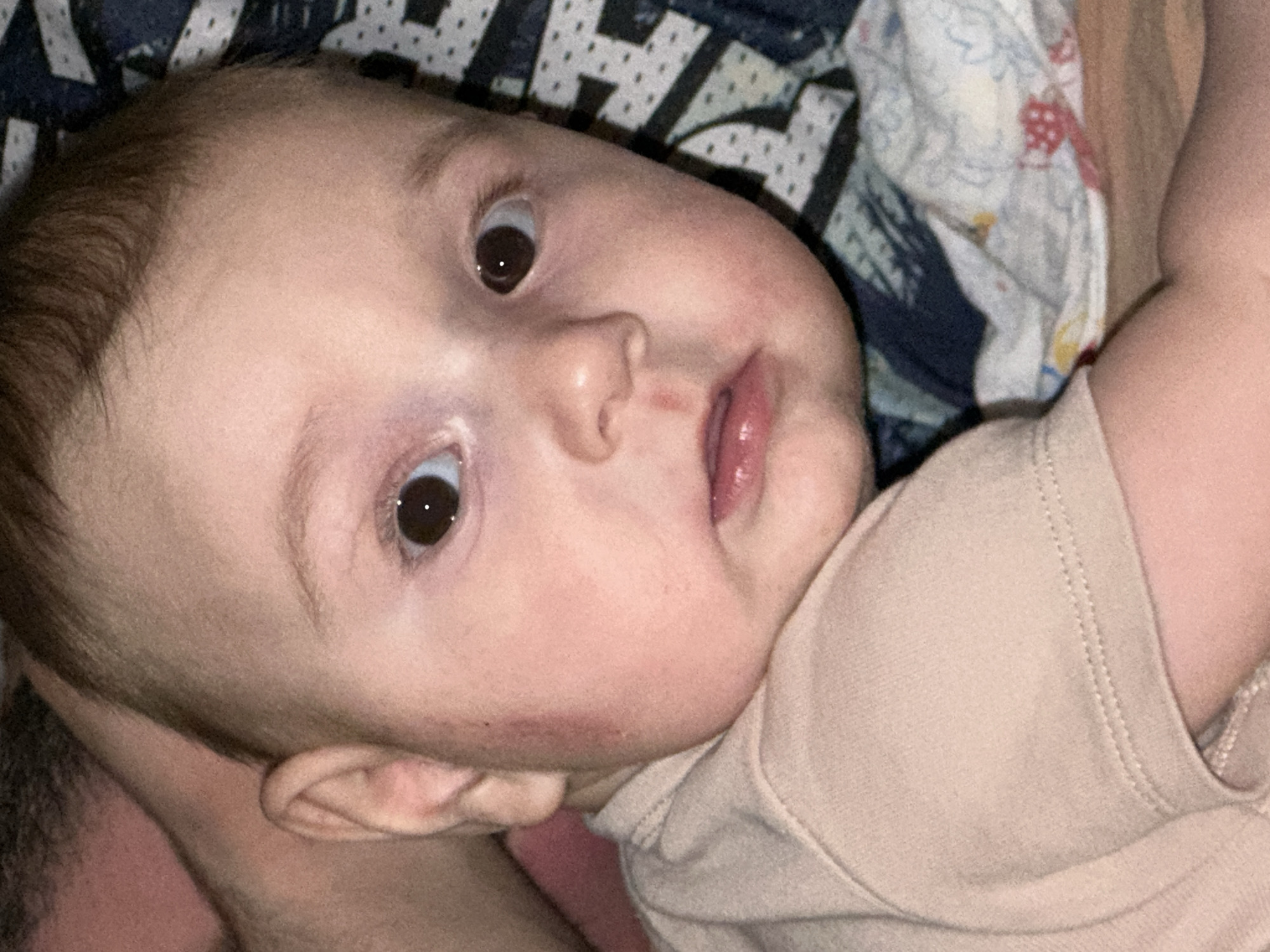 This close-up image features an infant positioned in an indoor setting within the city of Chaikovsky, Russia. The infant, with fair skin, wide dark brown eyes, and short light brown hair, gazes directly forward. A small red linear mark is present on the philtrum. A faint reddish area is visible on the infant's left cheek. The infant is clad in a plain, light beige short-sleeved garment. A portion of an adult's arm and shoulder, with light skin and dark hair, is visible in the upper-left, supporting the infant. The background consists of patterned fabrics: a dark blue fabric with light geometric patterns on the upper right, and a lighter, multi-patterned fabric with faded red, blue, and yellow elements in the lower right, indicative of bedding or a blanket.