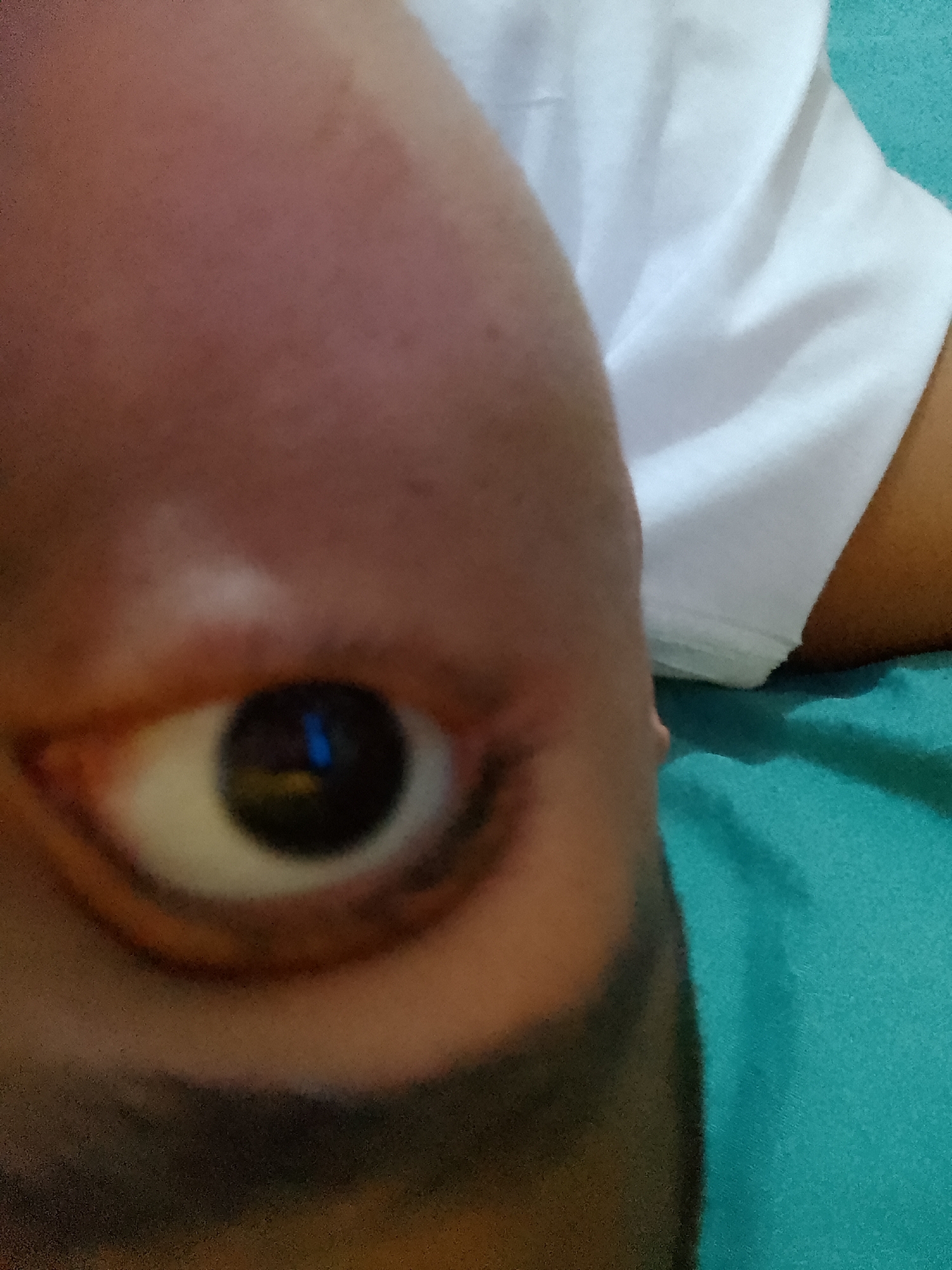 A close-up, rotated view of a person's eye and partial face. The eye is brown with a noticeable white sclera and dark eyelashes. The skin is brownish with some dark shading around the lower part of the face. A portion of a white t-shirt is visible in the upper right corner of the frame. The background is a teal-colored fabric, possibly a bedsheet. The image provides no information to suggest a location within Pampatar, Venezuela.