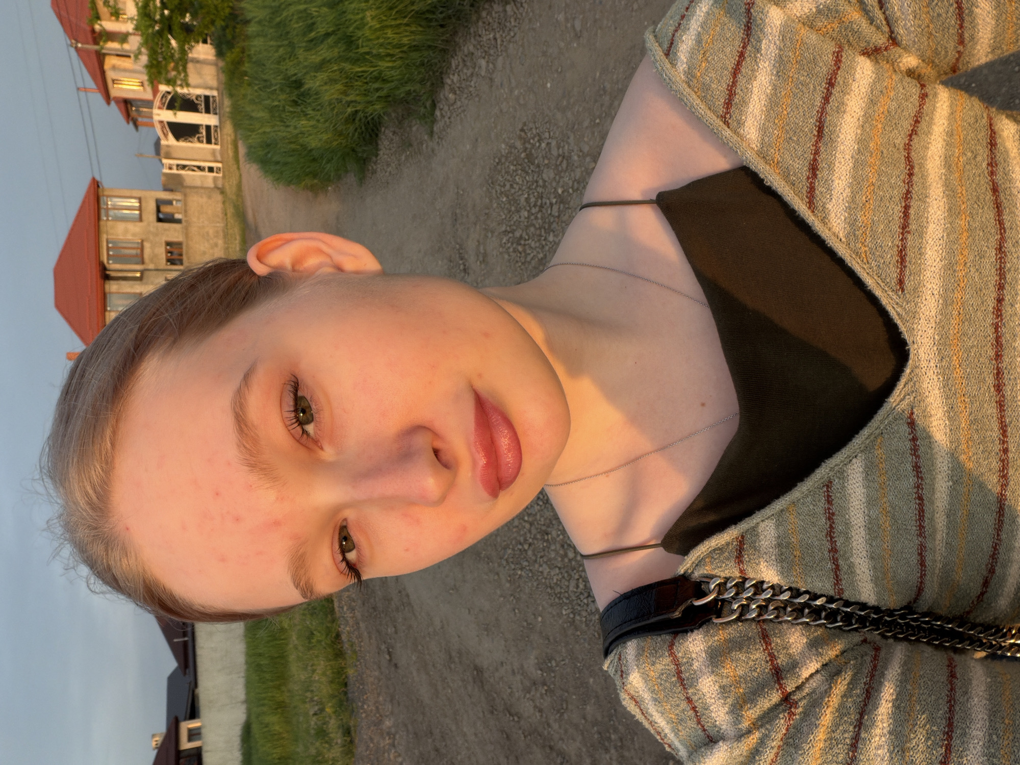 A young woman is photographed outdoors on what appears to be a gravel path, possibly in the area of Rossiyskiy, Russia, based on the architectural style of buildings visible in the background. She is facing the camera with her head tilted to the left. She has fair skin, visible facial blemishes, and light-colored hair pulled back. She is wearing a dark top under a striped knit cardigan or jacket. A thin necklace and a bag with a chain strap are visible. The background includes green grass, and a couple of multi-story buildings with red roofs, likely residential structures. The lighting suggests it is either sunrise or sunset.