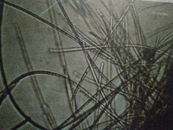 A microscopic view reveals a tangled mass of translucent, tube-like structures. These elongated shapes appear interwoven and overlap each other, creating a dense, irregular pattern against a gray background. The image suggests a biological or fibrous material, possibly algae, plant cells, or hair.