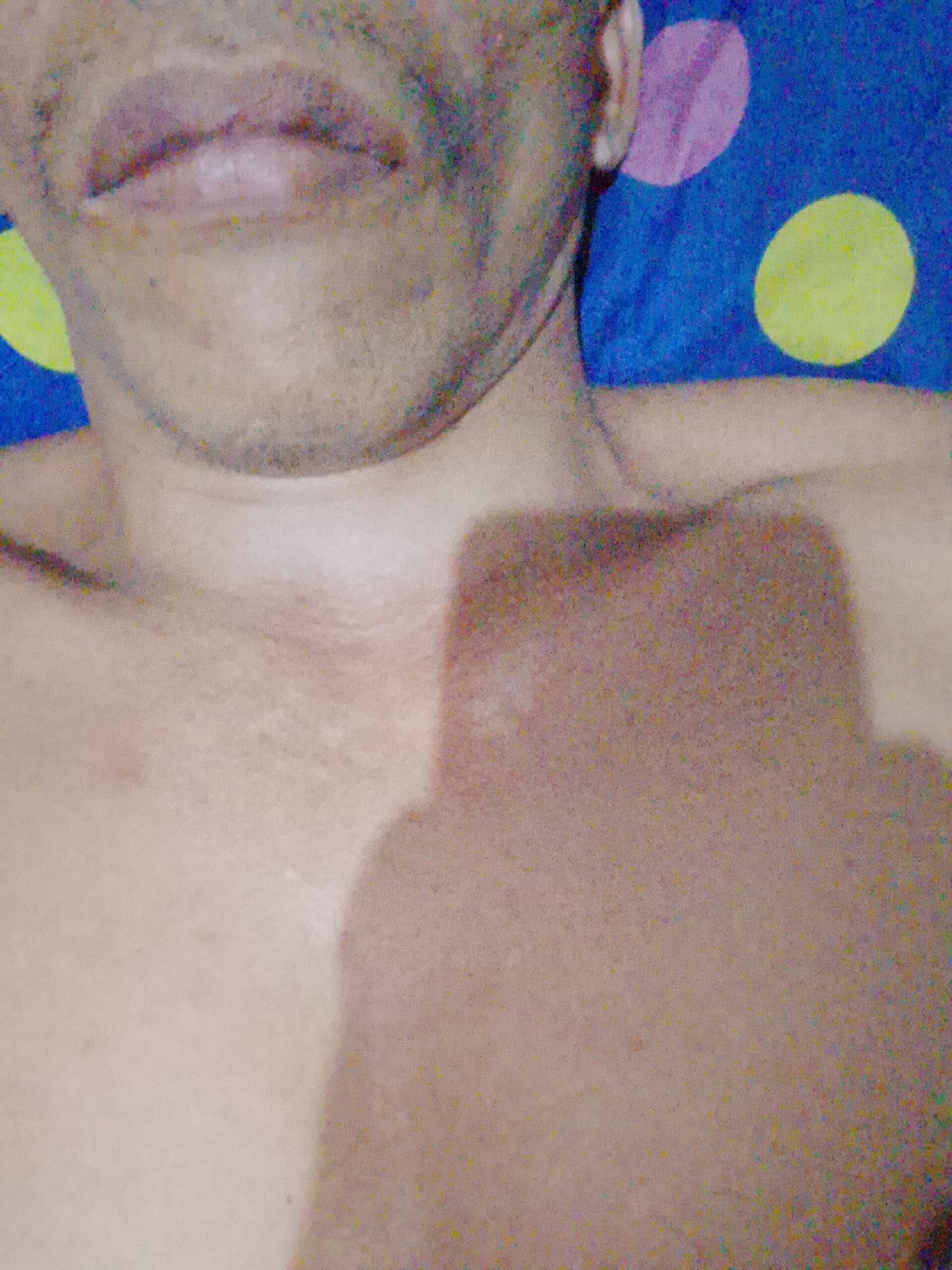 The image shows a close-up of a person's upper torso, neck, and part of the face, including the mouth and ear. The person is lying down on a blue fabric with purple and yellow polka dots. A shadow is visible across the person's chest. The image does not provide information to confirm the location in the city of Bukit Ketok, Indonesia.