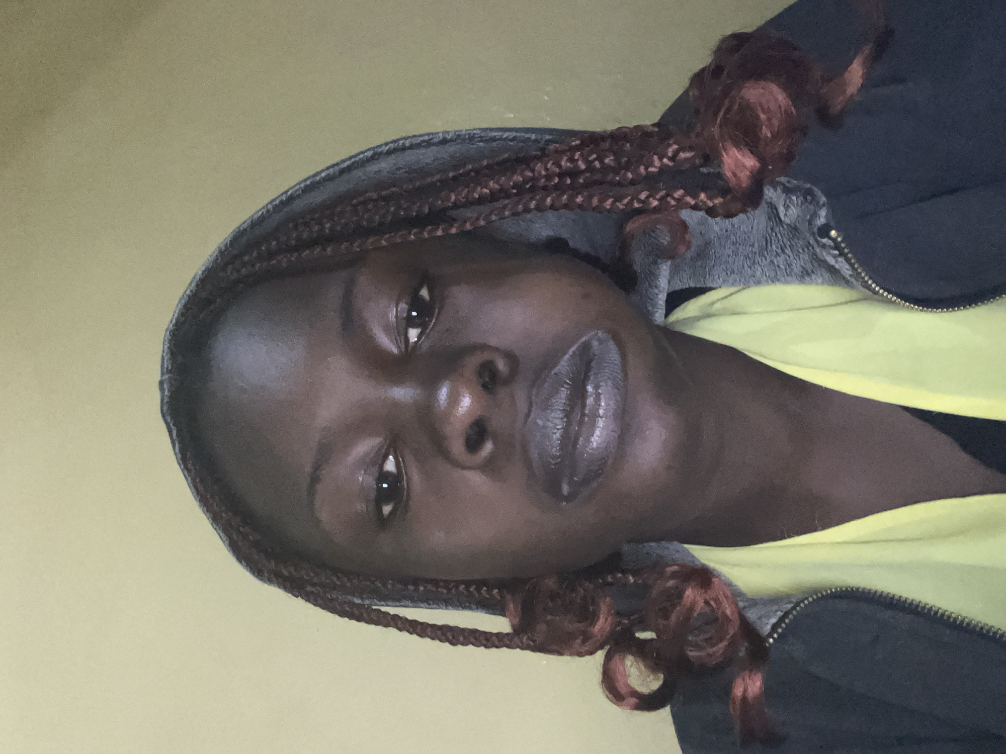 A medium shot captures a young Black woman with braided hair and dark skin. She is wearing a grey hooded jacket over a bright yellow garment, with a portion of her face visible. The woman's lips are noticeably light in color, possibly due to makeup or a natural pallor. Her expression is neutral, and she is looking directly at the camera. The background consists of a plain, light yellow wall, typical of an indoor setting in Jos, Nigeria. The lighting is even, suggesting artificial illumination. The overall scene is simple and focused on the subject.