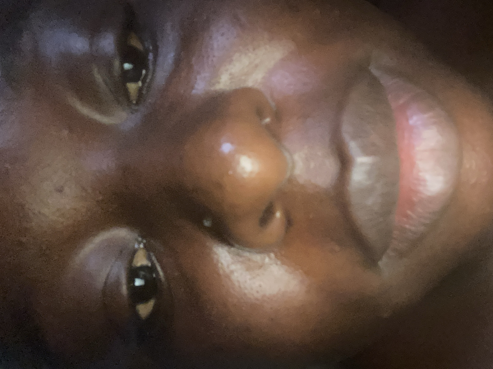 The image is a close-up, low-angle shot of a person's face, focusing on their eyes, nose, and lips. The skin tone is dark brown and appears to be slightly oily or dewy. The eyes are dark with visible reflections. The nose is round and fleshy, with a bright highlight on the tip. The lips are full and appear to be slightly parted, with a reddish-pink color and a glossy finish. The overall lighting is warm and appears to be from a direct source. There is no discernible background or environmental context visible, and therefore no information can be provided about its location in Jauro Yinu, Nigeria.