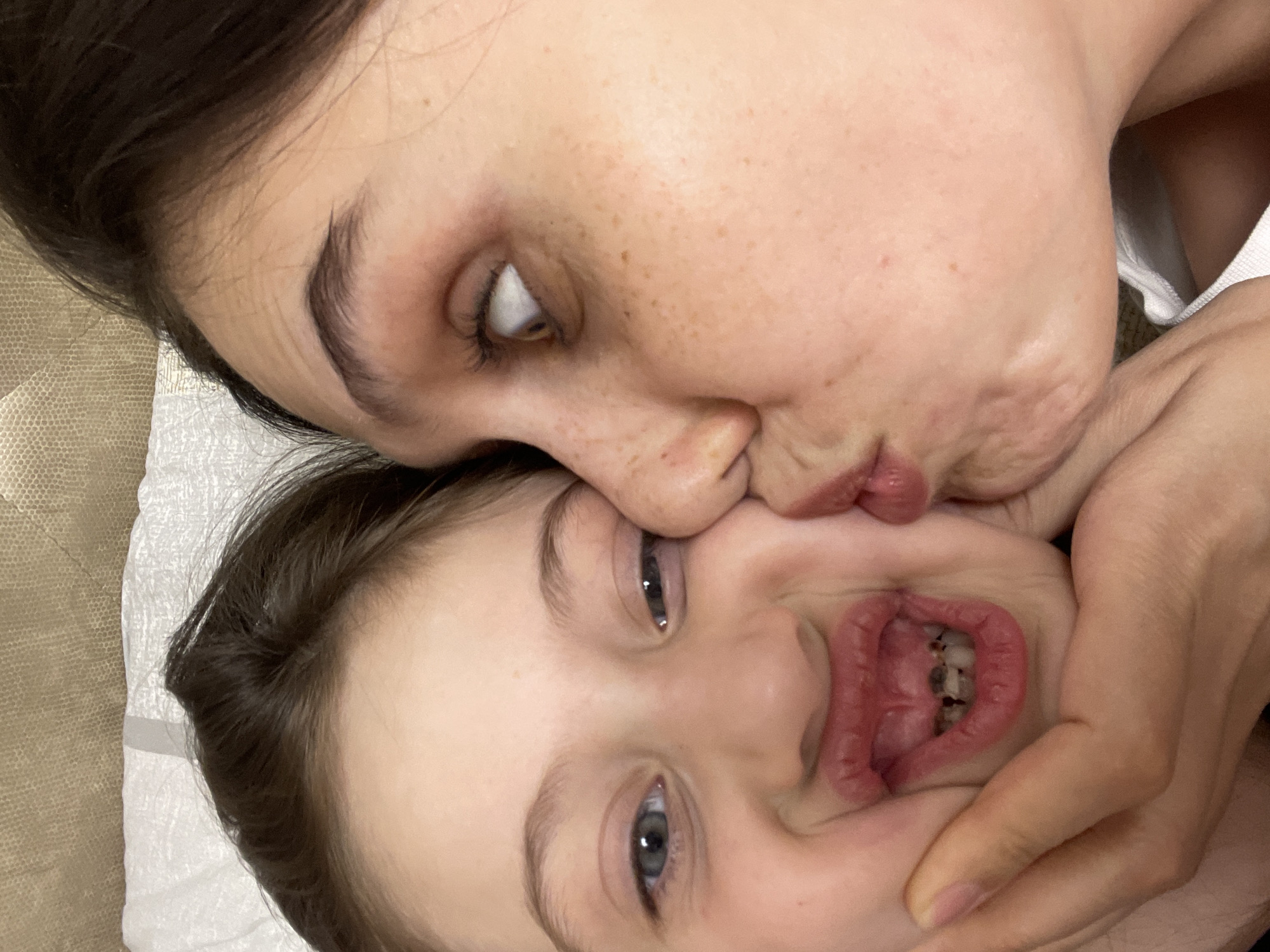 An indoor, close-up image, situated in Izhevsk, Russia, depicts an adult female kissing a child on the left cheek. The child, presenting with light brown hair and blue eyes, exhibits a playful facial expression; the mouth is open wide with pursed lips, revealing several anterior teeth that appear discolored or decayed. An adult hand, matching the skin tone of the female, is positioned against the child's chin and left cheek. The adult female, characterized by dark brown hair, light skin with visible freckles, and a white garment, directs her gaze upwards and to the right. The immediate background consists of a white textured fabric, likely a sheet or pillow, with a darker, textured, upholstered surface visible behind it, indicative of a domestic setting.