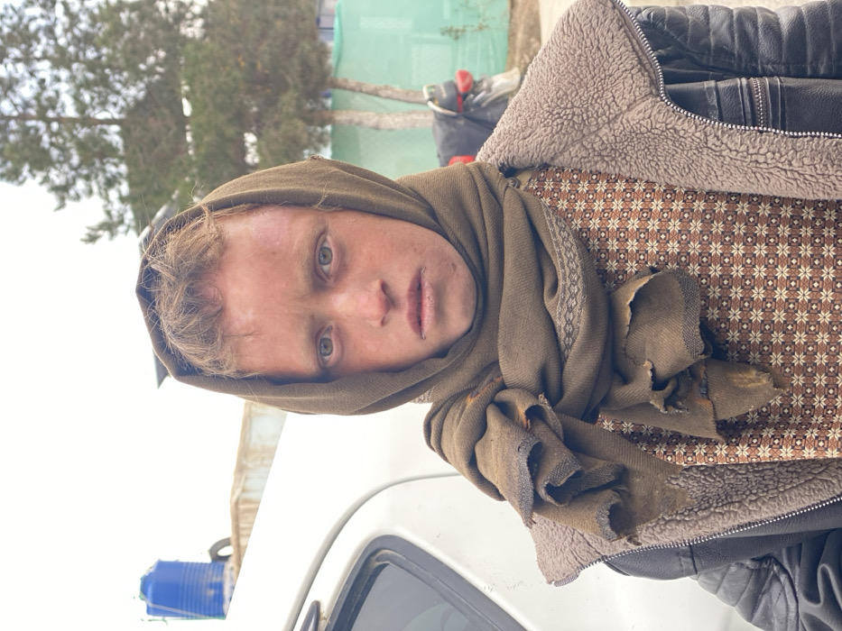 A young individual stands facing the camera outdoors in Kandahar, Afghanistan. The subject has fair skin, light eyes, and reddish hair visible beneath a worn, olive-brown scarf wrapped around their head and neck. The scarf appears dirty and frayed at the ends. The subject wears a brown shirt with a small geometric pattern and an open dark brown or black faux leather jacket with a light brown faux shearling lining. The subject's forehead and face display several discolored patches, and their lips appear chapped with visible irritation at the corners.
In the background to the left, a portion of a white vehicle is visible, behind which a blue cylindrical water tank stands on a support structure. Adjacent to the water tank, a light-colored rectangular container or building segment is present. To the right of the subject, two slender trees with sparse green foliage are visible, and in the far background, a light green mesh fence or barrier can be seen under an overcast sky. The subject is static, looking directly at the camera.