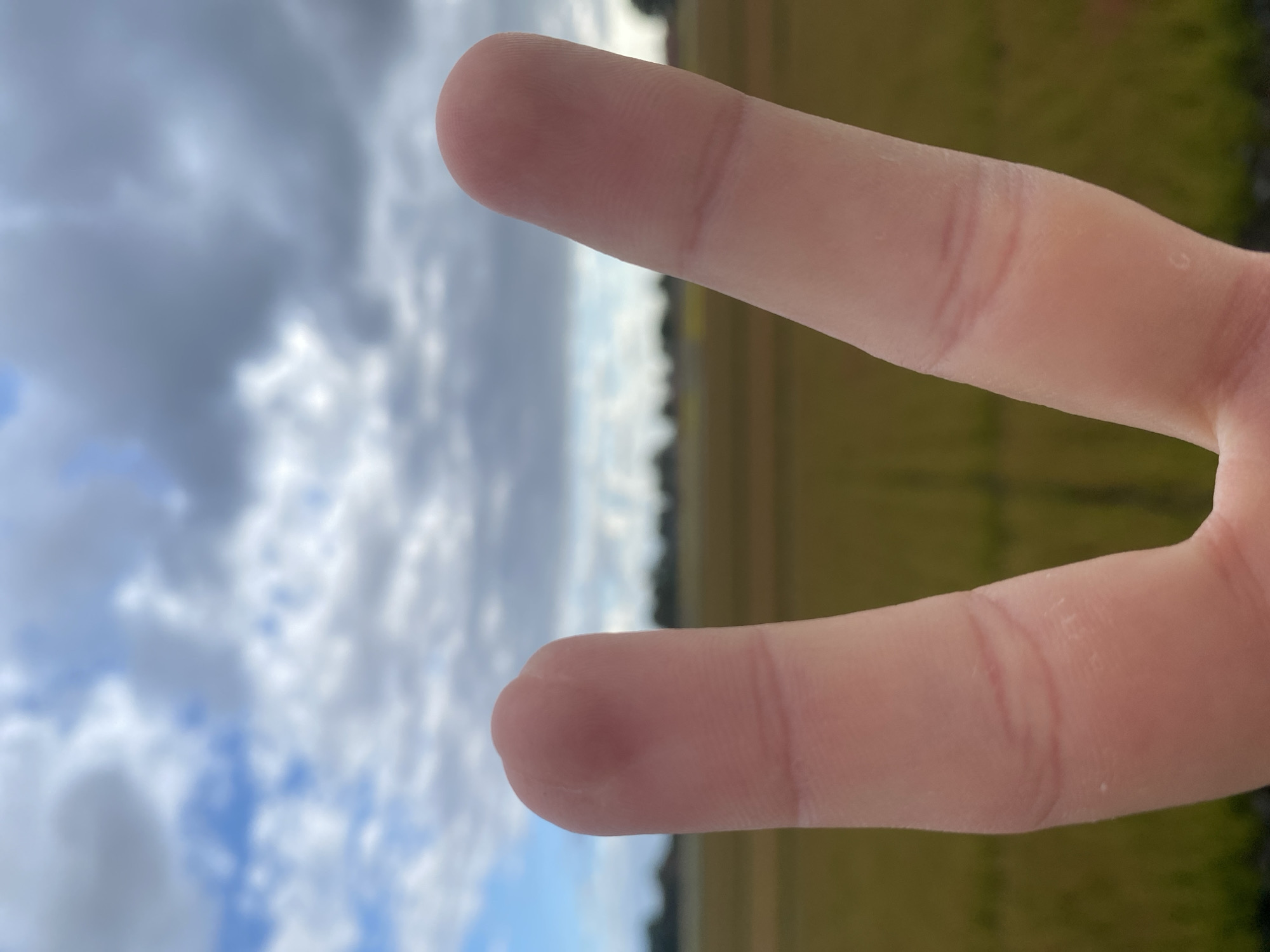 A close-up, waist-level, eye-level shot shows two fingers extended in a peace sign against a blurry background. The fingers, appearing to belong to a Caucasian individual, are pale pink and show visible skin creases. The index finger on the left is slightly foreshortened and shows a slight redness near the tip, possibly a bruise or irritation. The middle finger on the right is longer and angled slightly upward. The background is a blurred panorama of a flat, green and yellow field, possibly farmland, bordered by a line of dark green trees on the horizon. The sky above is filled with a mix of white and dark gray clouds, suggesting an overcast or partly cloudy day. The scene lacks specific identifying landmarks that would pinpoint its location within Schwarme, Germany.