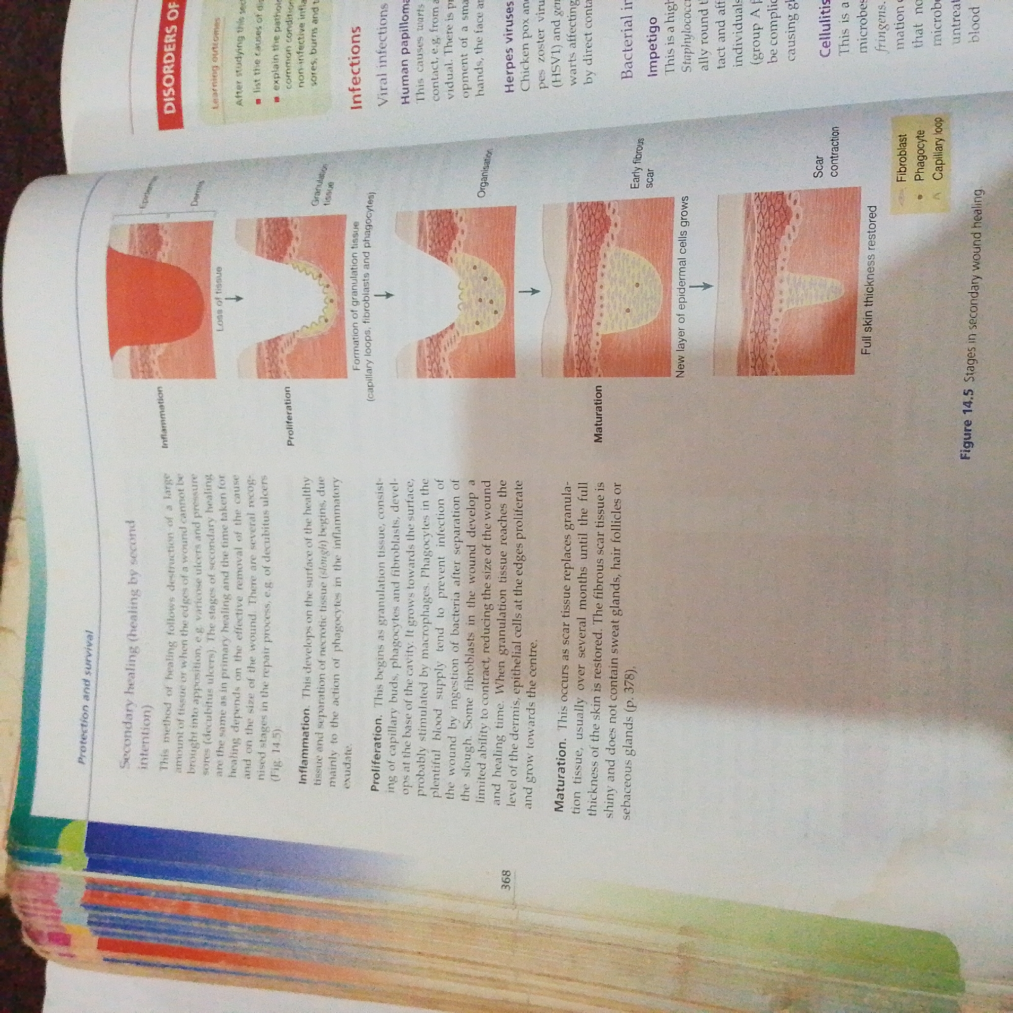 The image displays a page from a textbook or educational material. The content is primarily text and illustrations related to wound healing and infections.
On the left side of the page, there is a section titled "Protection and survival," with a subsection on "Secondary healing (healing by intention)." This is accompanied by a diagram illustrating the stages of wound healing, including "Loss of tissue," "Inflammation," "Proliferation," and "Maturation." The illustrations depict changes in skin tissue at a microscopic level as a wound heals.
To the right of the wound healing diagram, there is a section on "Infections," detailing viral infections (like Herpes viruses and Chicken pox) and bacterial infections (like Impetigo and Cellulitis). This section also includes small illustrative diagrams of bacterial and viral structures.
At the bottom of the image, a page number "368" is visible. There is also a heading "Figure 14.5 Stages in secondary wound healing."
The image does not contain any elements or information that would allow for the description of a location in Jalingo, Nigeria. The content is purely academic and illustrative.