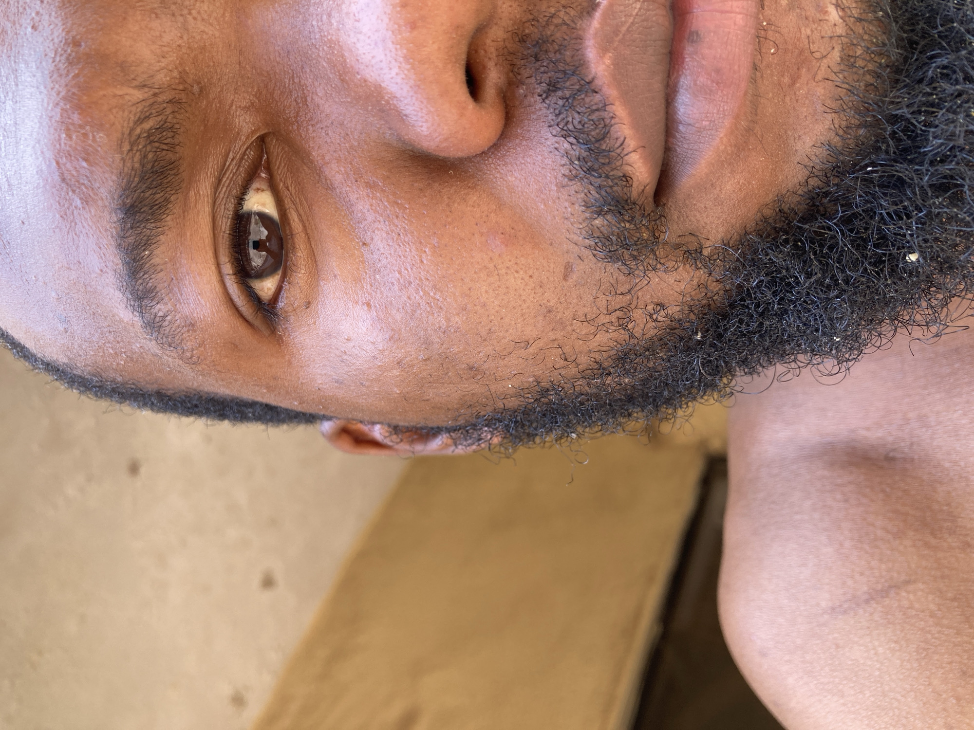 A close-up, vertically oriented shot of a Black man's face from the bottom up. The man has dark brown skin, a brown eye visible in the upper left, and a beard of black and gray hair. The lower part of his face and neck are visible. A wooden-like surface is partially visible at the bottom. It is not possible to determine the specific location within Jos, Nigeria, based on the image.