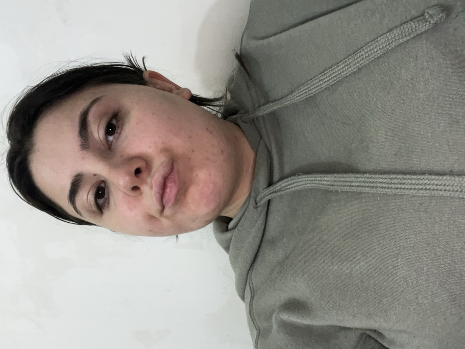 The image displays a close-up portrait of a young adult female, reportedly located in Talin, Armenia. The subject is centered, looking directly at the camera with her lips pursed in a "duck face" expression. She possesses dark hair, dark eyes, and prominent eyebrows. Her skin exhibits minor blemishes, including a small mole on her left cheekbone and faint freckles. She is dressed in a light olive-green or grayish-green hooded sweatshirt, with the light-colored, ribbed drawstrings visible around the neckline. The background consists of a plain, light-colored wall, likely white or off-white, which appears to have minor textural irregularities.
