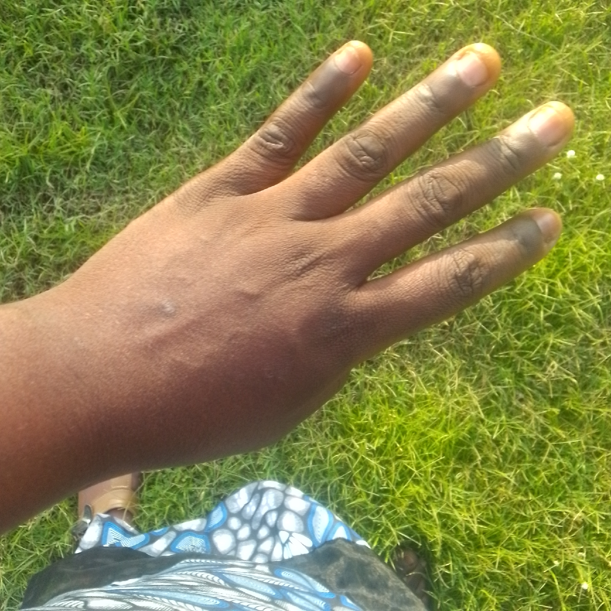 The media file is an outdoor, close-up shot of a person's hand held up against a backdrop of lush green grass. The hand is positioned in the center of the frame, with the fingers slightly spread. The skin tone of the hand appears to be dark. The fingernails are visible and have a light, yellowish tint. Subtle lines and creases are visible on the skin of the hand, suggesting an adult. The grass is dense and appears to be well-maintained, with some areas showing brighter green hues, possibly indicating sunlight. In the lower portion of the frame, a small section of patterned fabric and a glimpse of a tan shoe are visible, suggesting the person is seated or has their legs extended on the grass. The overall lighting suggests it is daytime, possibly sunny, given the brightness of the grass and the subtle shadows cast on the hand. There is no visible text in the image. The scene evokes a sense of relaxation or a casual outdoor moment.