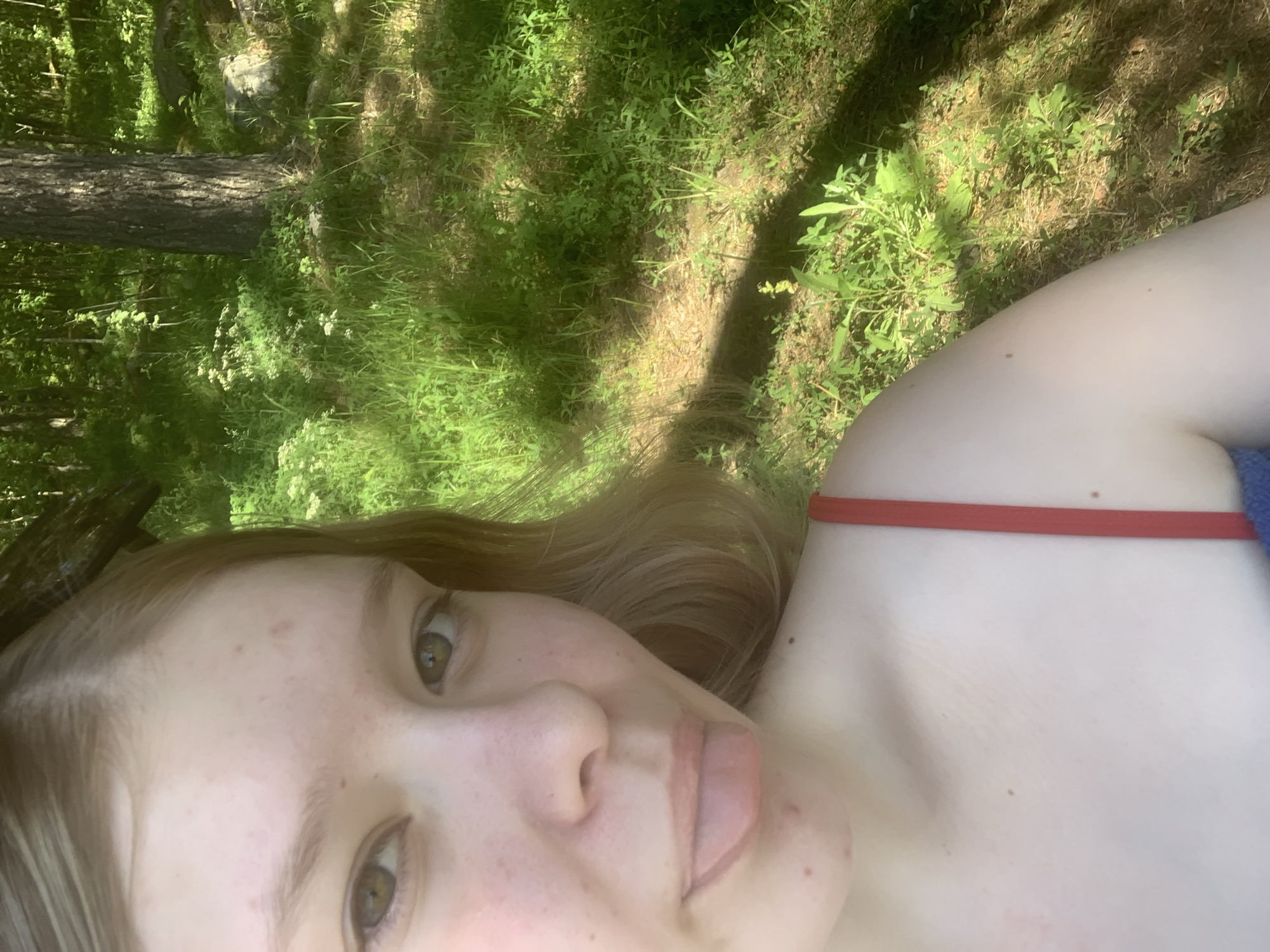 This image depicts a close-up, upward-angled selfie of a young individual, likely female, positioned in the left foreground against an outdoor, sunlit, wooded backdrop in the city of Boitsovo, Russia. The individual has fair skin, light brown hair parted centrally, and greenish-hazel eyes. She is looking towards the camera with her tongue slightly extended. Visible on her face and left shoulder are several minor skin blemishes and freckles. She wears a red spaghetti strap top, with a glimpse of a blue garment visible lower on her left side. The background features a large, dark-barked tree trunk centrally on the right, surrounded by dense green grass, various foliage, and several grey rocks. Strong sunlight creates distinct shadows across the ground and highlights the vibrant greenery.