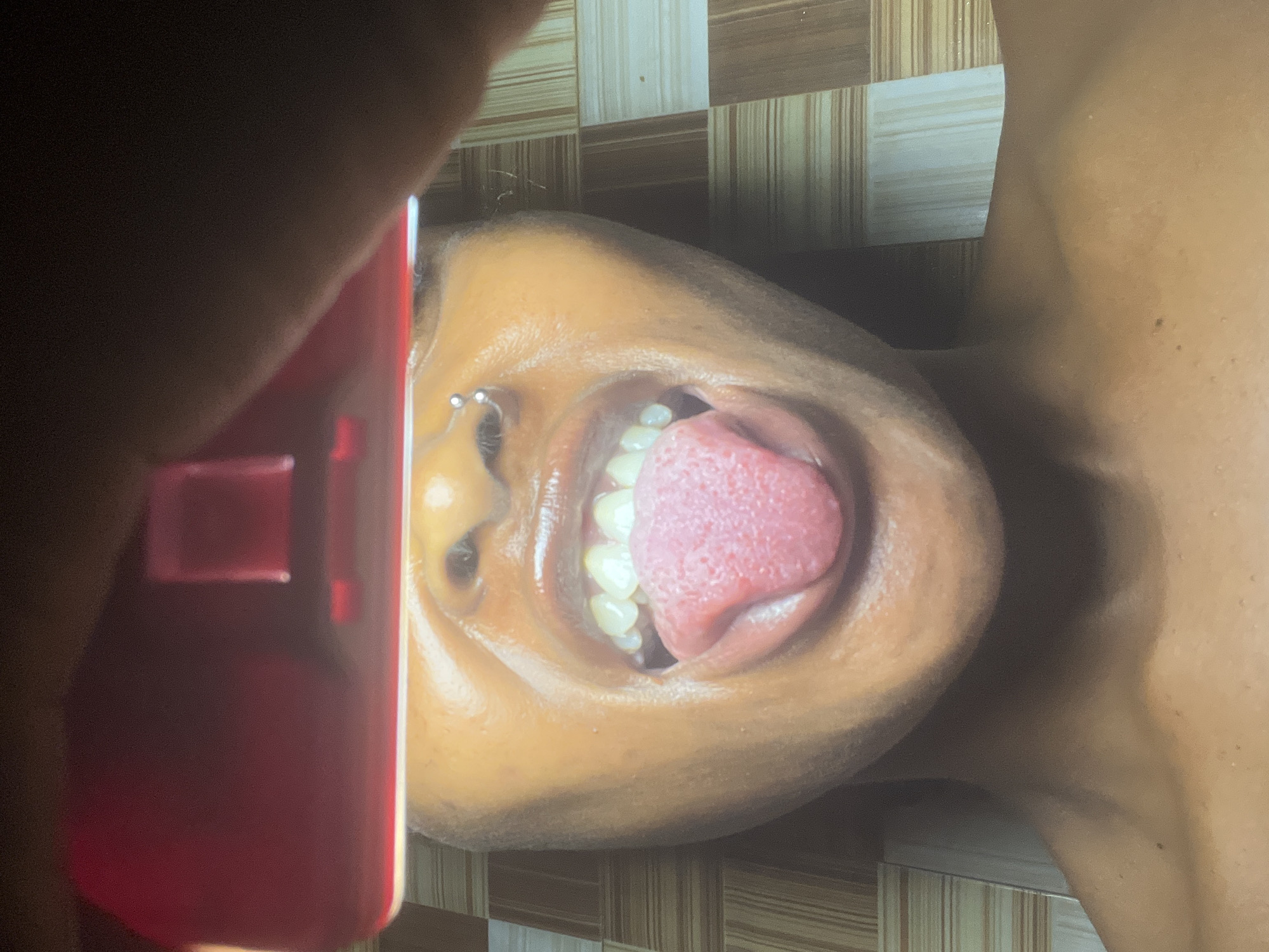 The image shows a close-up of a person's mouth with their tongue extended. A red object, likely a phone, is held above the person's head, casting a shadow. The background appears to be a tiled wall with a striped pattern. The person has a nose ring. The scene is set in Ado, Nigeria.