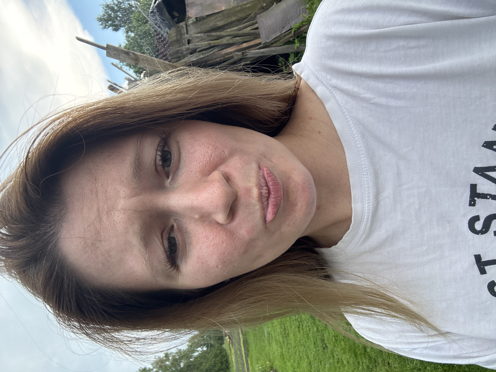 The image is a close-up selfie of a young woman with light brown hair, wearing a white t-shirt, with a slightly displeased expression and pursed lips. Her skin appears to have visible pores and some redness. She is outdoors, with a background of green grass and trees. To the right of the woman, there is a pile of weathered wooden planks and some wire mesh, suggesting a rustic or perhaps construction area. The sky is partly cloudy. The image appears to be taken in a rural or semi-rural setting, not within the city of Вассята, Russia, as there are no urban elements visible.