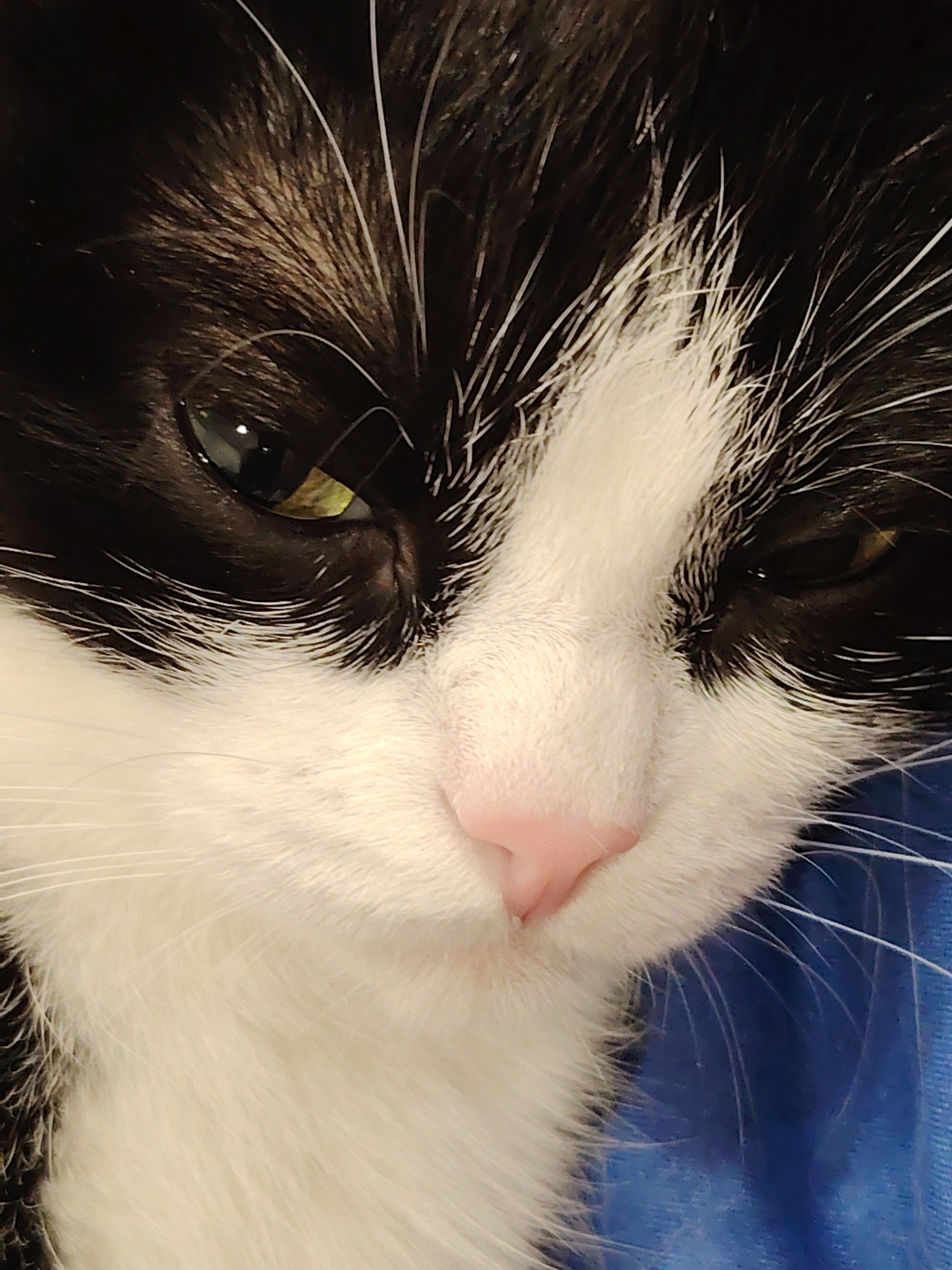 A close-up, eye-level, medium shot shows the face of a black and white cat with its head tilted. The cat's left eye is partially closed and appears yellow-green. Its nose is pink and its whiskers are white and prominent. The cat's fur is a mix of black and white. The background is a blurry, dark blue texture, possibly fabric. The image is well-lit, and the focus is sharp on the cat's face. The location is Unknown, Unknown.