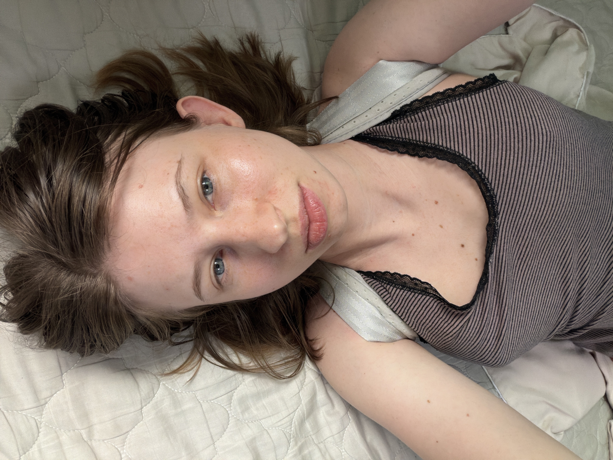 An overhead shot shows a woman lying on her back on a light-colored, quilted surface, possibly a mattress or bed. She has fair skin with some freckles and redness on her cheeks. Her eyes are blue and open, looking directly at the camera. Her hair is brown and slightly messy, fanning out around her head. She is wearing a striped tank top with a black lace trim. The background is the quilted surface she is lying on, with a hint of a light-colored blanket or sheet to her right. There are no visible distinguishing landmarks or indications of the city of Dongducheon-si, South Korea, in this image.