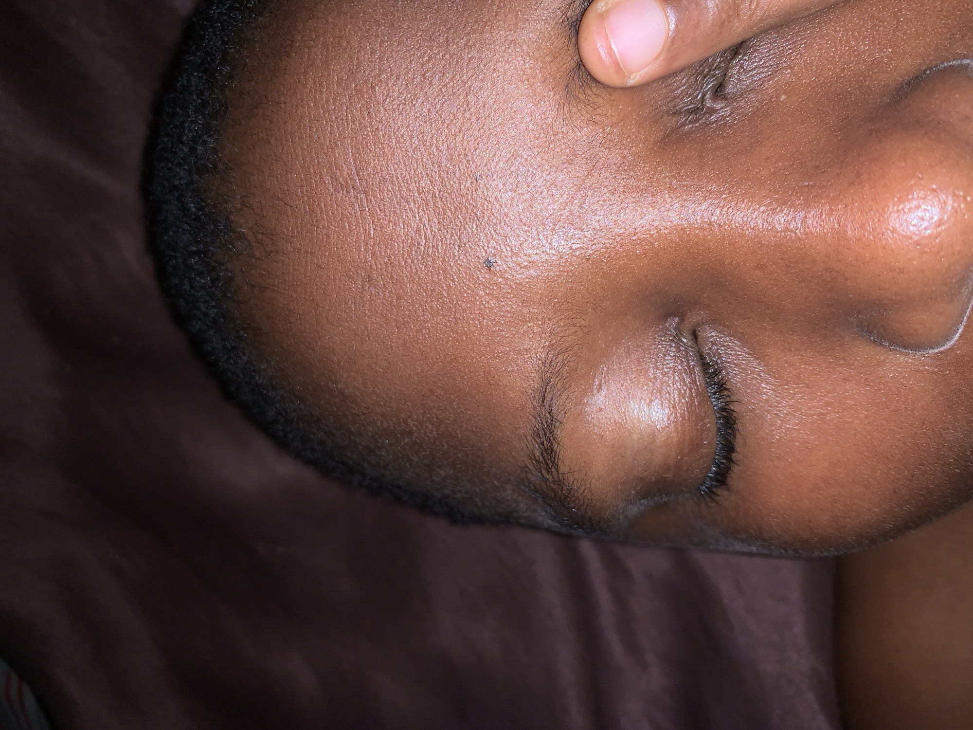 The image depicts a close-up of a person's face. The person appears to be resting, with their eyes closed. A finger is partially visible at the top of the frame, near the person's eye. The individual has dark skin and short, dark hair. A mole is present on their cheek. The background is a dark, solid color. There is no indication of the city of Ikorodu, Nigeria, or any other specific location.