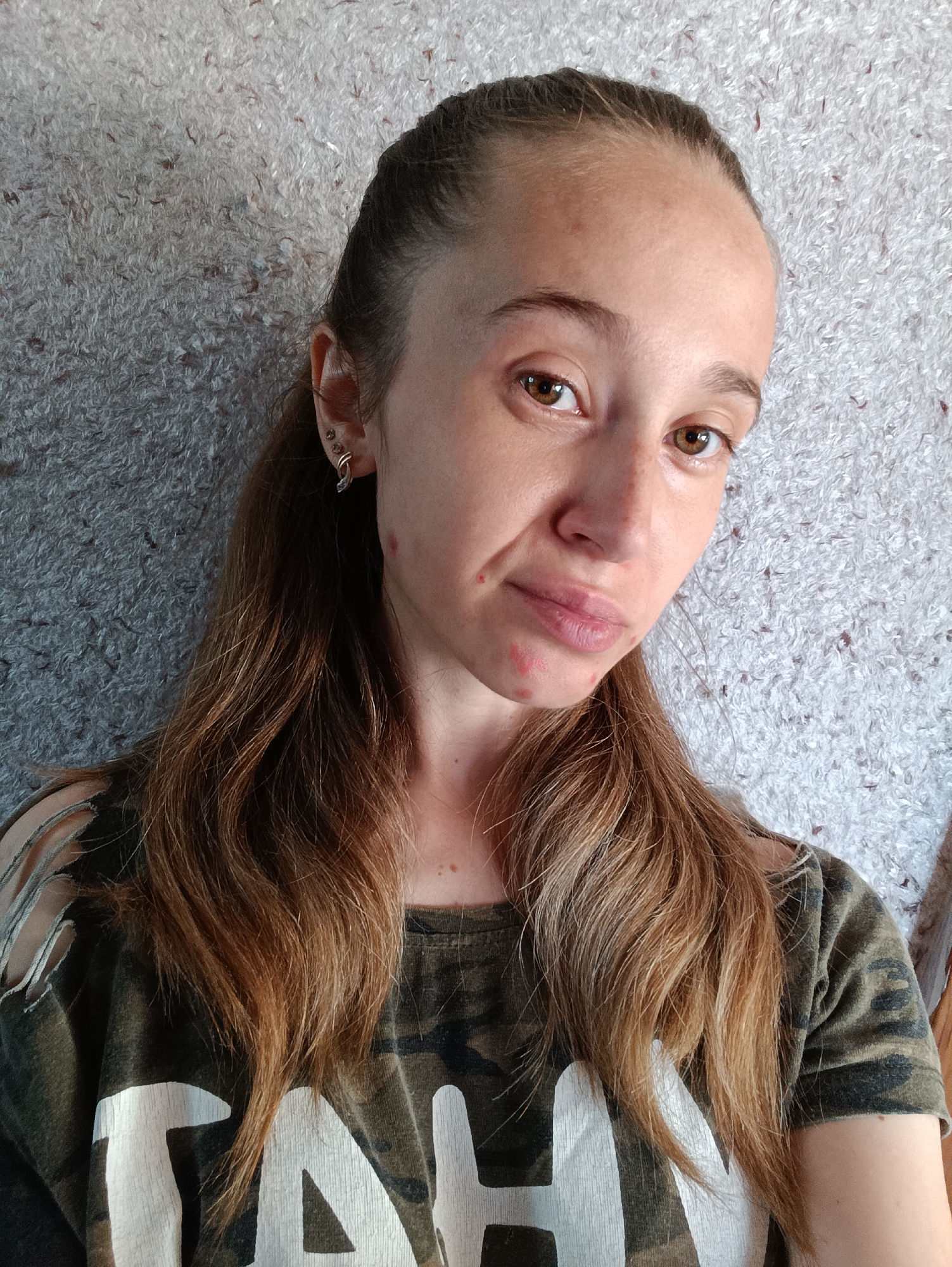 A young woman with light brown hair pulled back into a ponytail poses for a selfie against a textured, light-colored wall. She is wearing a camouflage t-shirt with distressed detailing on the shoulders and white lettering on the front. She has multiple small red blemishes on her face, particularly around her mouth and chin, and is wearing earrings. The image is a medium close-up, capturing her from the chest up. The location is Vypasne, Ukraine.