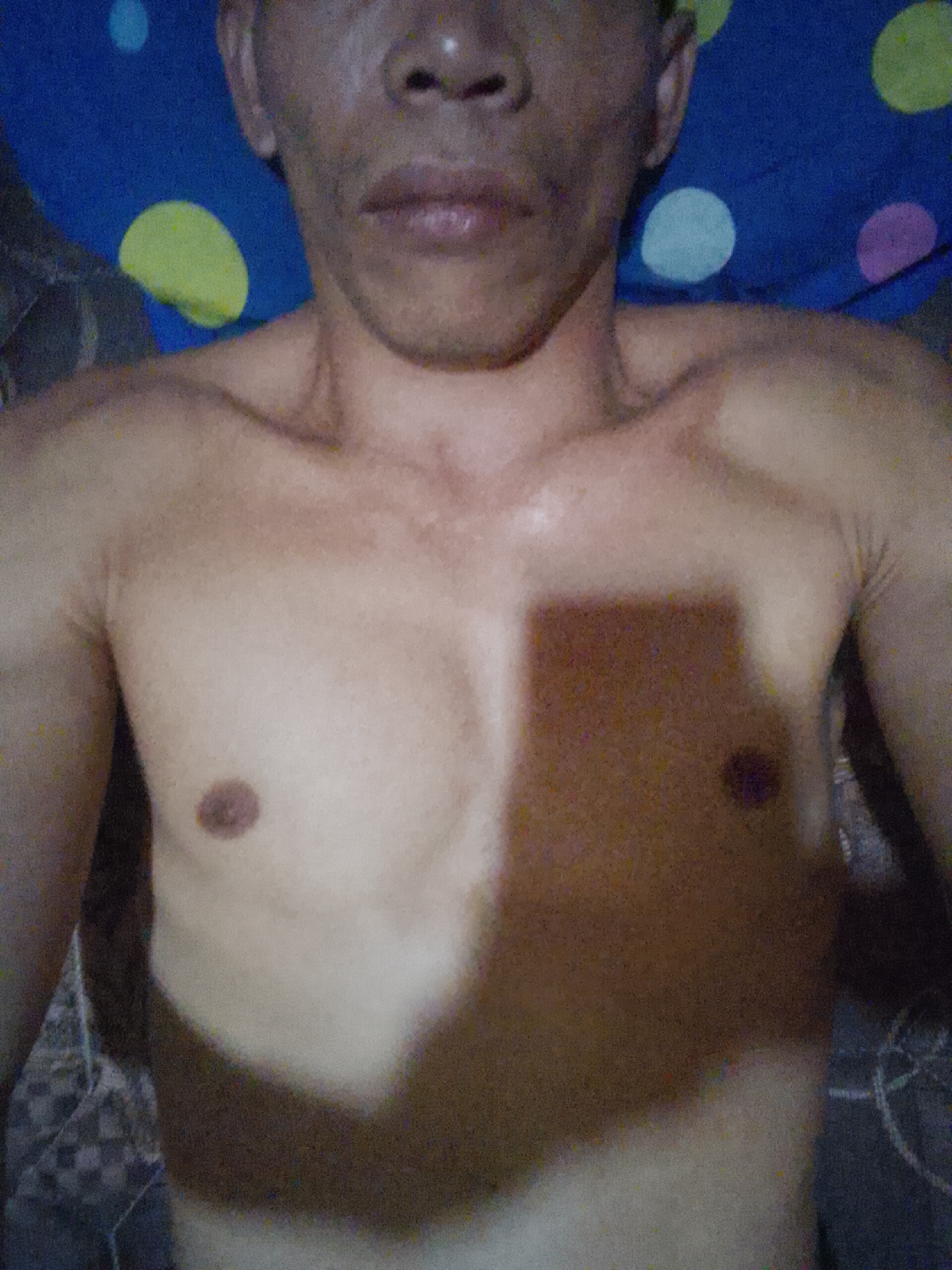 The image shows a close-up, chest-up view of a shirtless individual lying down, with a dark blue fabric with colorful polka dots as a backdrop. The person appears to be in a dimly lit environment, possibly a bedroom, given the presence of a pillow or blanket. The individual's skin tone is visible, with clear definition of the chest muscles and nipples. A shadow falls across the right side of the chest, obscuring some details. The face is partially visible at the top of the frame, showing the mouth and nose, with the head tilted slightly back. The lighting is inconsistent, creating a shadow that divides the chest area. There are no other people or objects clearly discernible in the immediate vicinity. The setting does not provide any specific indicators of its location within Madukoro, Indonesia.