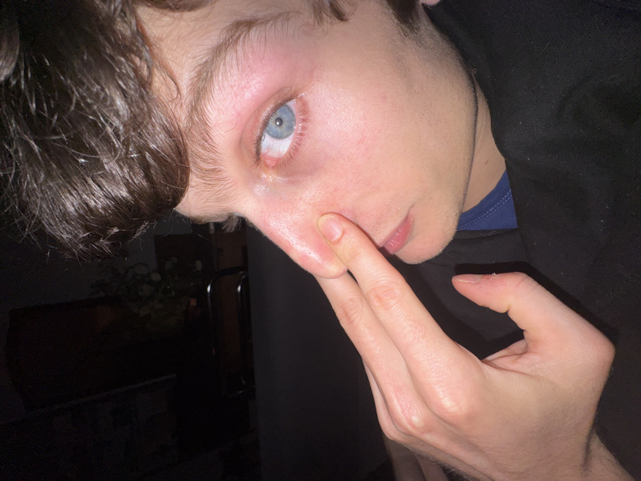 A close-up, slightly low-angle image depicts the upper right quadrant of a fair-skinned young adult male's face, encompassing his right eye, nose, and mouth, along with his left hand. The individual possesses dark brown hair and a visible blue right eye, which shows a reddened sclera and lower eyelid. His left hand is positioned with the index and middle fingers applying pressure to the bridge and right side of his nose, an action that appears to slightly distort the nose's shape. The subject is wearing a dark-colored garment, possibly a hoodie or long-sleeved shirt, visible at the bottom right. The background is dimly lit and largely underexposed, revealing faint outlines of what appears to be furniture and a floral arrangement. The specific location within Paris, France, is not discernable from the visual information provided in the image.