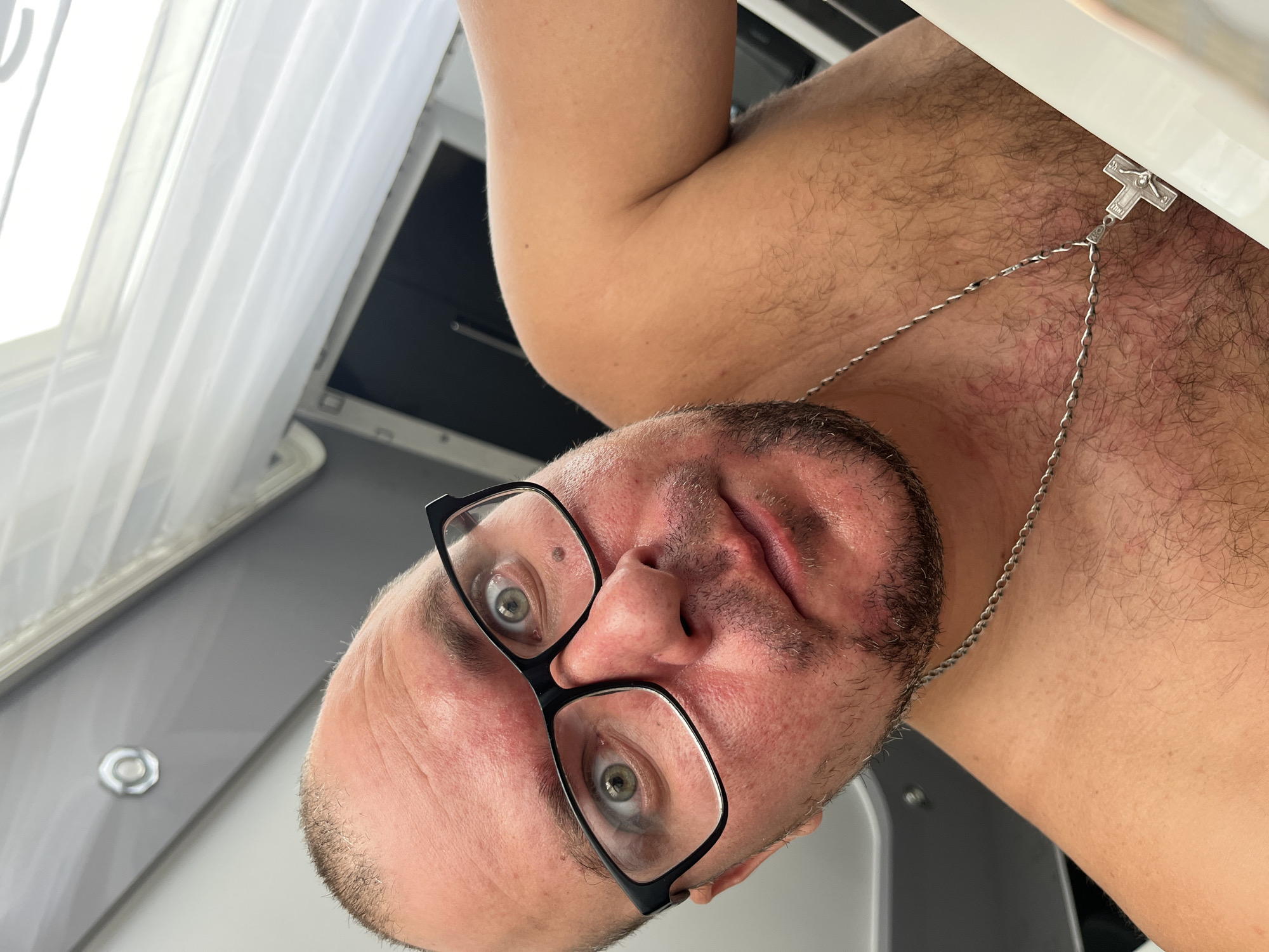A close-up, selfie-style photograph shows a shirtless man with a shaved head, wearing black-rimmed glasses. His eyes are wide, and he appears to be looking directly at the camera. He has stubble on his chin and jawline, and a silver chain with a crucifix pendant around his neck. Redness is visible on his forehead and cheeks. The background appears to be an interior space, possibly a bathroom, with a white curtain or blind to the right and a gray ceiling with a light fixture above. There is no indication of the city of Minsk, Belarus.