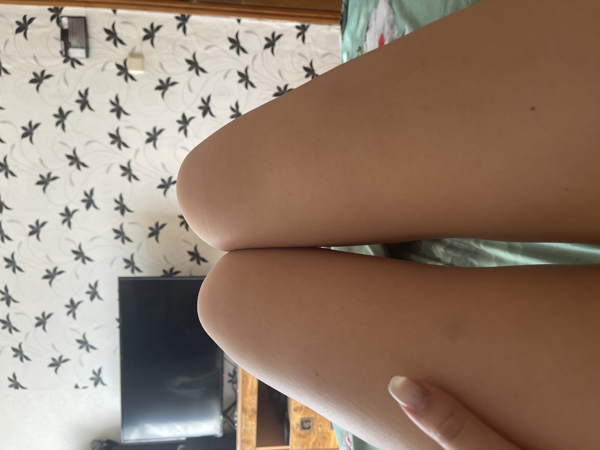 The image shows a close-up view of a person's legs, specifically the thighs and knees, resting on a bed. The legs are smooth and tanned. A hand with a light-colored manicure is visible on the left side of the frame, touching one of the legs. The background features a patterned wallpaper with black floral designs on a white background. To the left of the legs, a portion of a television screen and a wooden cabinet are visible. The scene appears to be indoors, likely a bedroom in Shcherbinka, Russia.