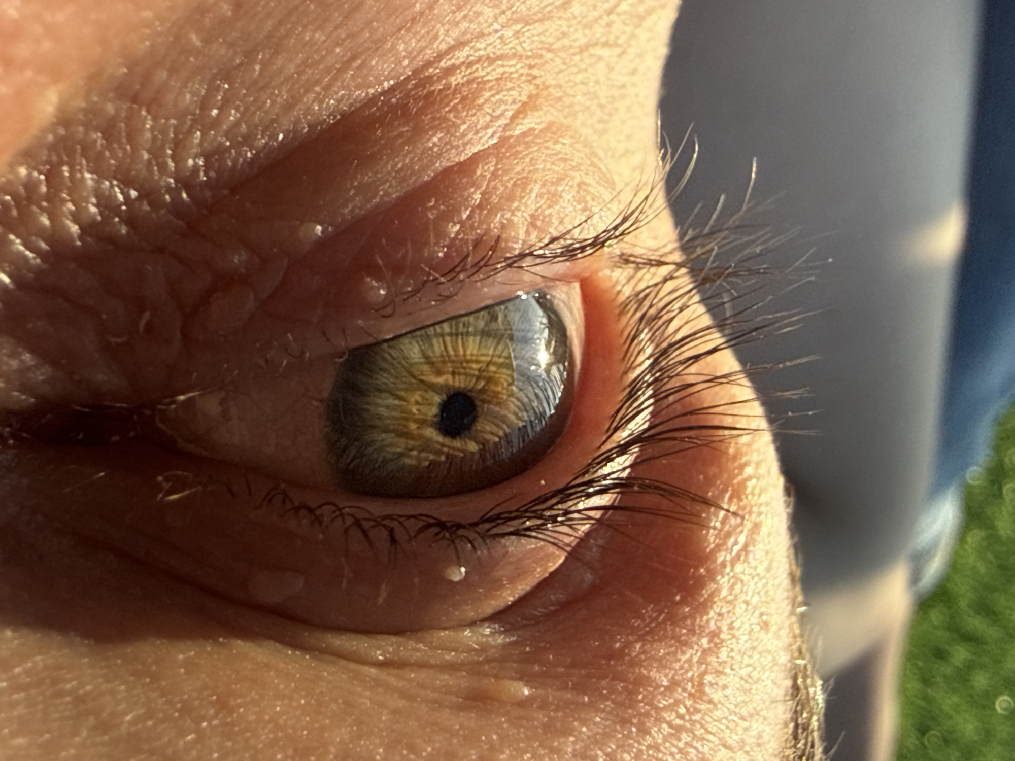 This is a close-up, Dutch angle, extreme macro shot of a human eye, with the iris a mix of green and yellow with a black pupil. The eye is heavily lit by sunlight, causing reflections on the surface of the eye and highlighting the texture of the eyelid and surrounding skin, which appears to have small bumps and possibly sweat or moisture. The eyelashes are dark and prominent. In the background, out of focus, is a blurry expanse of dark blue and green, with some circular highlights that suggest bokeh effects, possibly from sunlight filtering through leaves or water. The lower portion of the image shows glistening moisture or liquid falling from the eye area. The scene appears to be outdoors on a sunny day, with hints of grassy areas. The image has no discernible connection to Chaikovsky, Russia, or any urban environment.