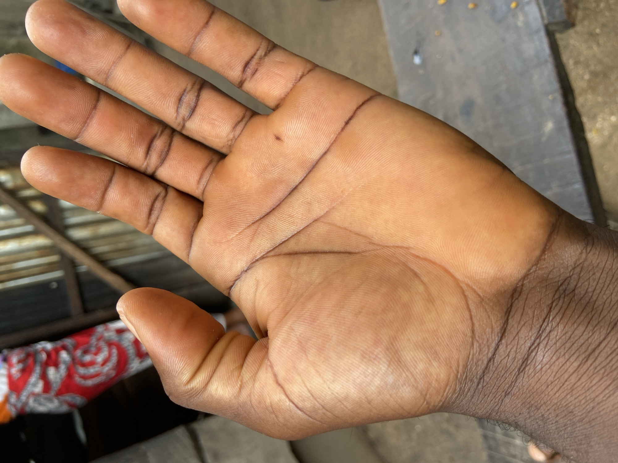 The image features a close-up of a human left hand, palm facing upwards. The hand belongs to a person with dark skin. Several distinct, dark lines are drawn across the palm and along the creases of the fingers, including the thumb, index, middle, and ring fingers. These lines appear deliberate, possibly drawn with a marker or ink, and are separate from the natural palm lines. A small, dark spot is also visible on the palm, near the base of the middle finger.
The background is out of focus, providing glimpses of a rustic setting. To the left, a patterned red and white fabric is visible, possibly clothing or a blanket. Above it, a corrugated metal roof structure can be seen. On the right side of the background, a dark, flat surface, possibly ground or a wooden plank, is partially visible. The lighting is bright and natural, suggesting it is daytime. The scene evokes a location such as Mararaba, Nigeria, consistent with the provided context. No text is visible in the image.