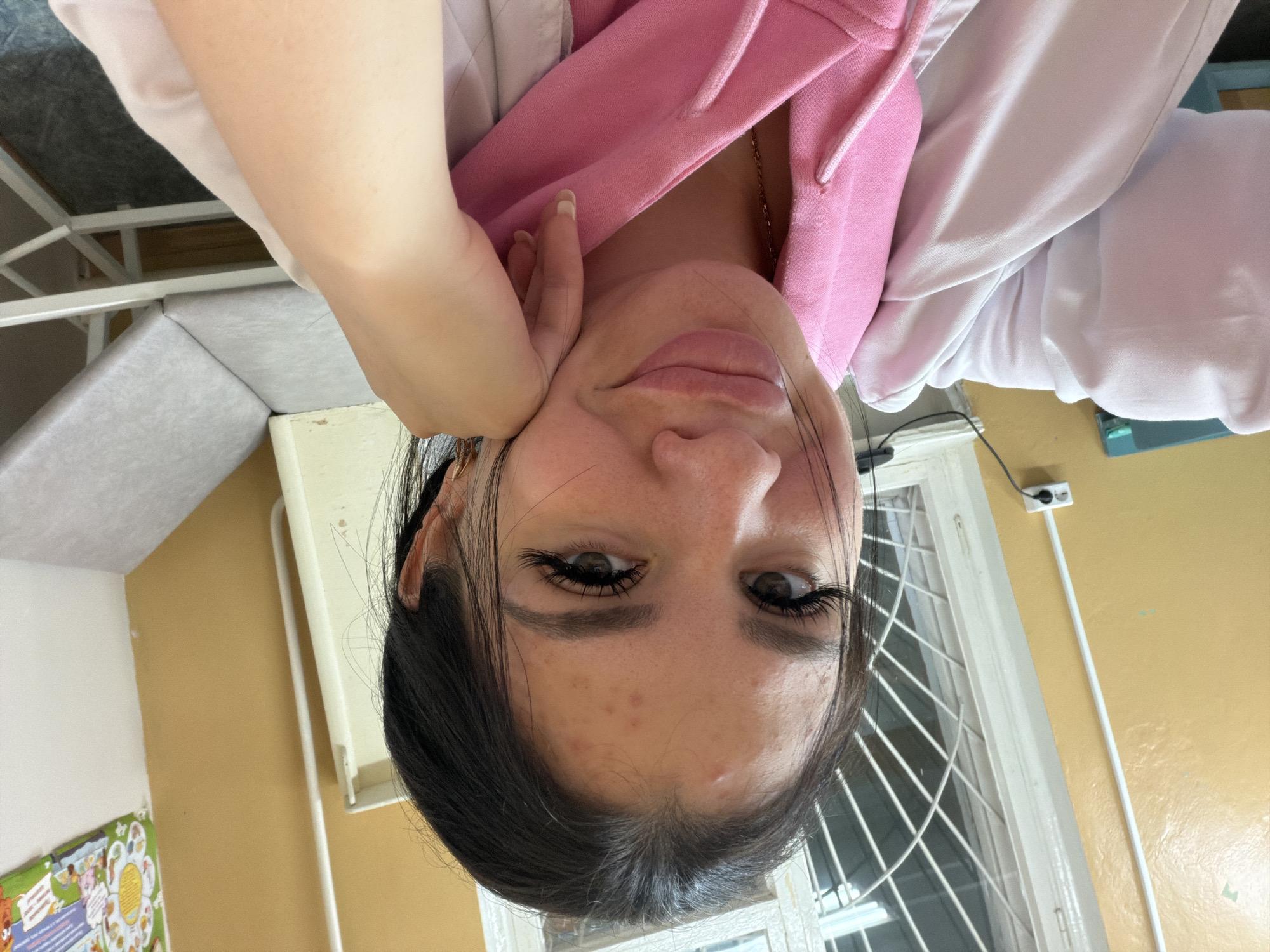 A young woman with dark hair and prominent eyelashes rests her head on her hand, looking at the camera. She is wearing a pink hoodie underneath a light-colored lab coat, suggesting a possible medical setting. Her face shows several blemishes on her forehead and cheek. In the background, a window with a barred grate is visible, along with yellow walls and a gray examination table, consistent with a clinic or hospital room. A colorful poster hangs on the wall.