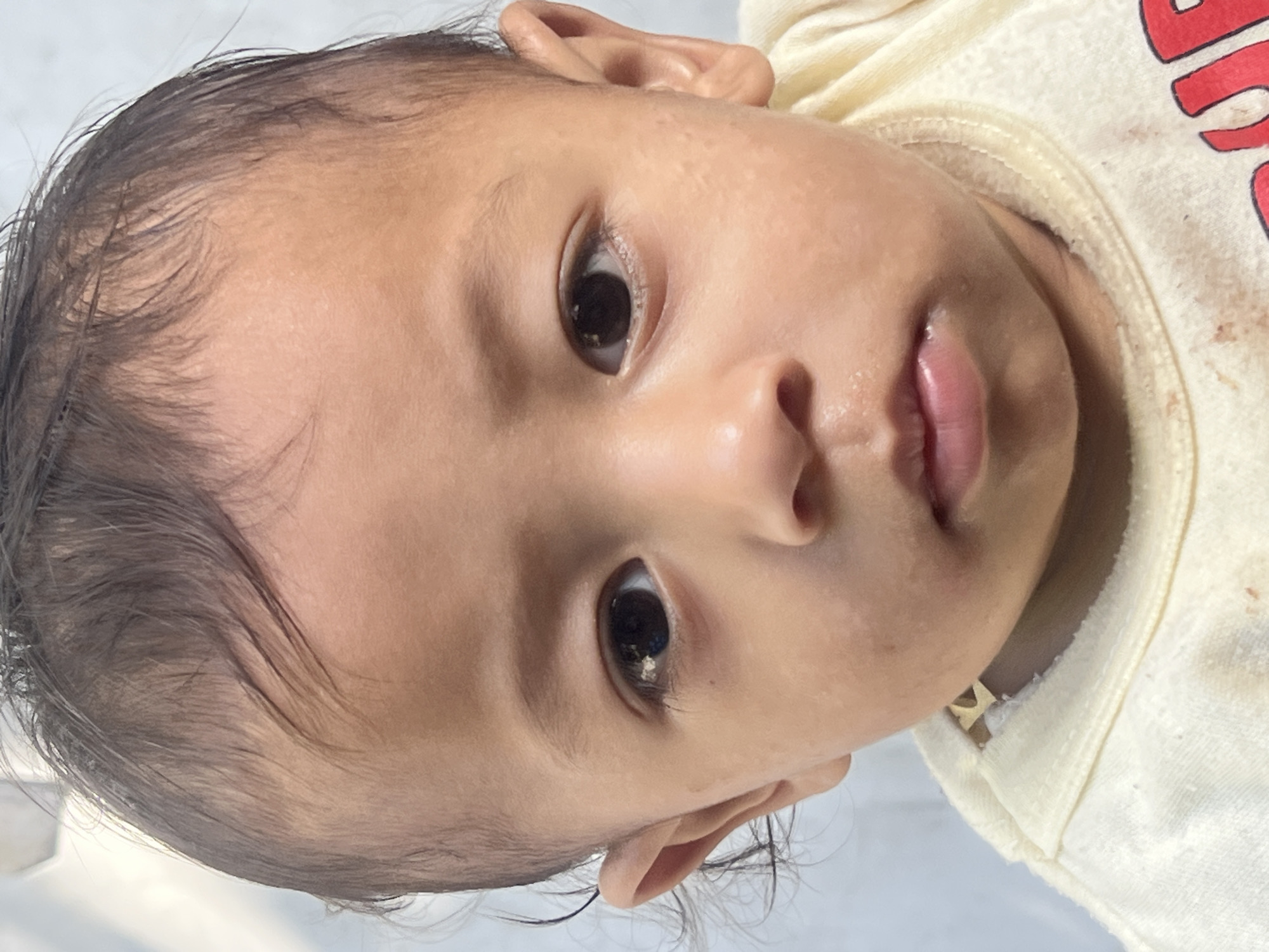 A close-up, headshot photograph of a young child is presented. The child's face is the primary focus, with their dark hair neatly styled and framing their forehead. Their skin appears smooth and slightly tanned, with a few minor blemishes visible on the cheeks. The child's eyes are dark and expressive, looking directly at the camera. The nose is small and delicate, and the lips are full and slightly parted. The child is wearing a light-colored garment, possibly a t-shirt or onesie, with a visible collar and some staining. The background is indistinct, suggesting an indoor or softly lit environment. The image quality is good, with clear details and natural lighting. The photograph does not depict any specific location in Denpasar, Indonesia, or any identifiable landmarks.