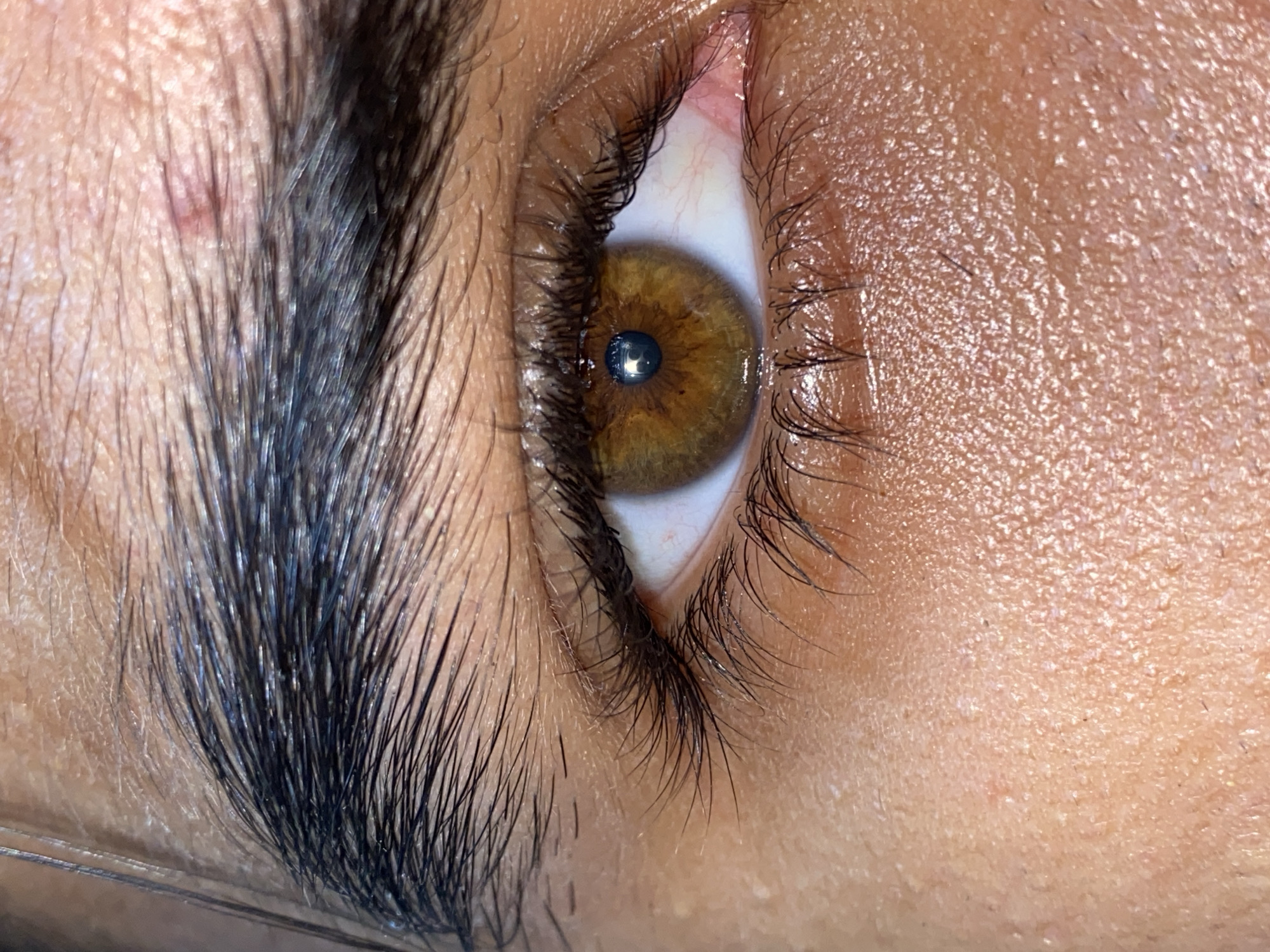 This image depicts a close-up view of a human right eye, located in Juan Griego, Venezuela. The subject's skin tone is a light to medium tan. The iris is predominantly hazel, featuring a blend of warm brown tones with a darker brown limbal ring and radiating patterns of lighter brown around the pupil. The pupil is black and centrally located, displaying a distinct circular reflection of a light source, appearing as a bright bluish-white ring with a dark center. The sclera is white with visible reddish capillaries, particularly towards the inner corner of the eye. Both upper and lower eyelids are visible, lined with dense, dark, and long eyelashes. A portion of a thick, dark eyebrow is present at the top of the frame. The skin surrounding the eye exhibits fine texture and pores, and a small, reddish mark is visible on the skin above the eyebrow. No explicit actions or interactions are discernible.