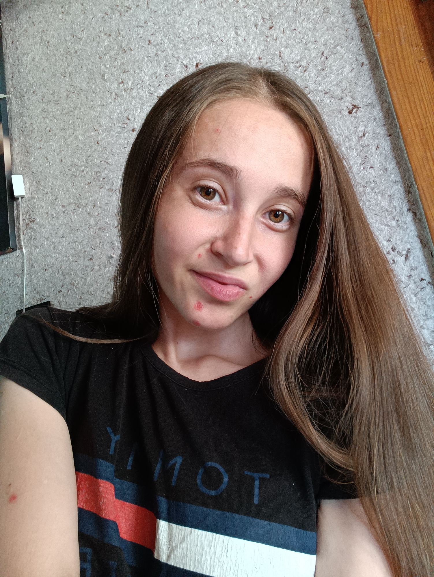 A young woman with long, brown hair is taking a selfie indoors. She is wearing a black t-shirt with red, white, and blue stripes. There are several red blemishes on her face and left arm. The background appears to be a wall with a textured pattern and a wooden surface to the right. The image does not contain any information indicating its location in Vypasne, Ukraine.