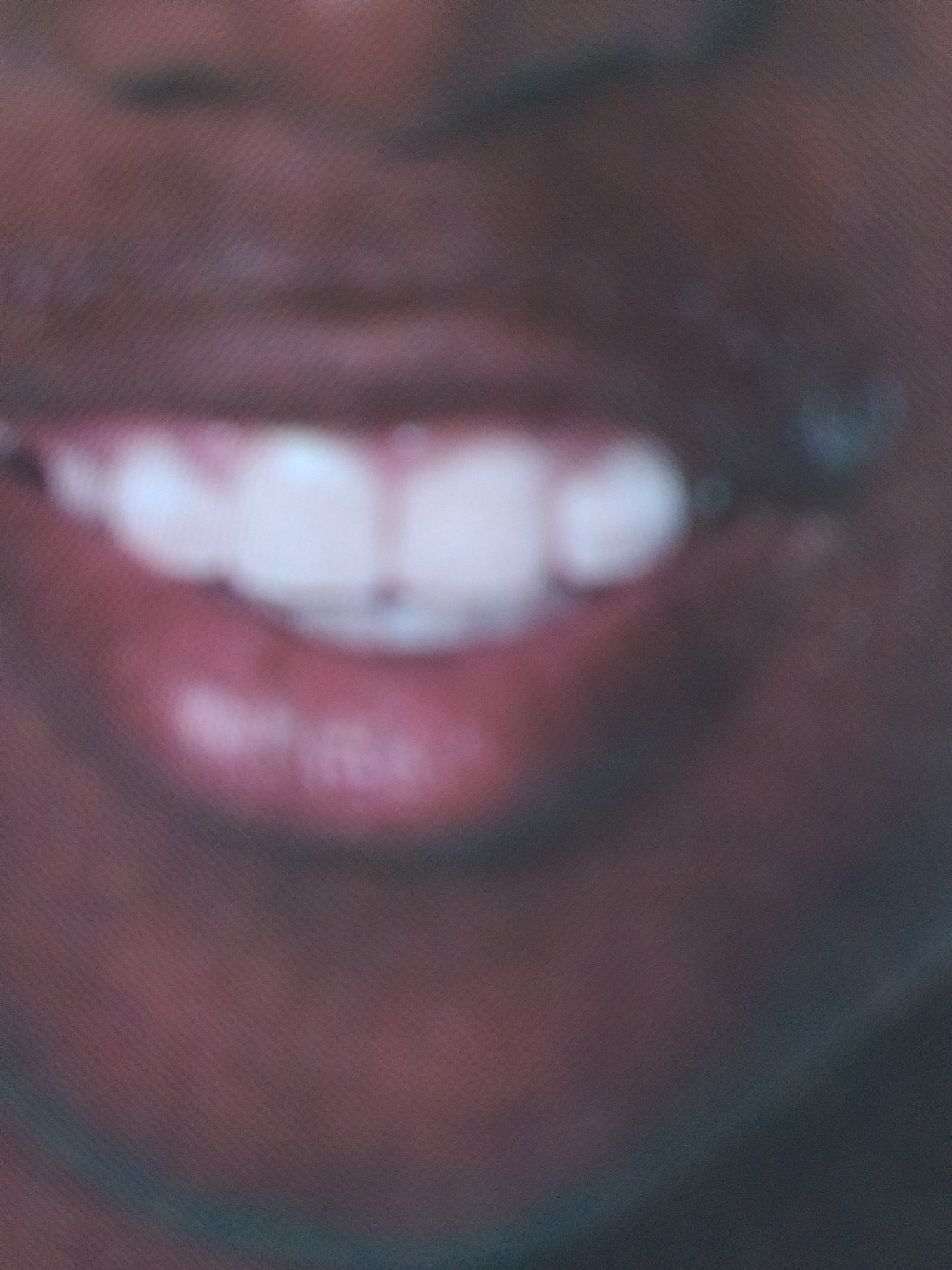This is a close-up, slightly out-of-focus media file showing a person's mouth, with a focus on their teeth and lips. The skin tone appears to be dark, and the lips are full and red. Several teeth are visible, appearing white and somewhat rounded. The lighting suggests an indoor setting or an area with diffused light, as there are no harsh shadows. The overall impression is of a person smiling or about to speak. No text is visible in the frame. The context of La Tagua, Venezuela does not provide any specific visual cues within the image itself.