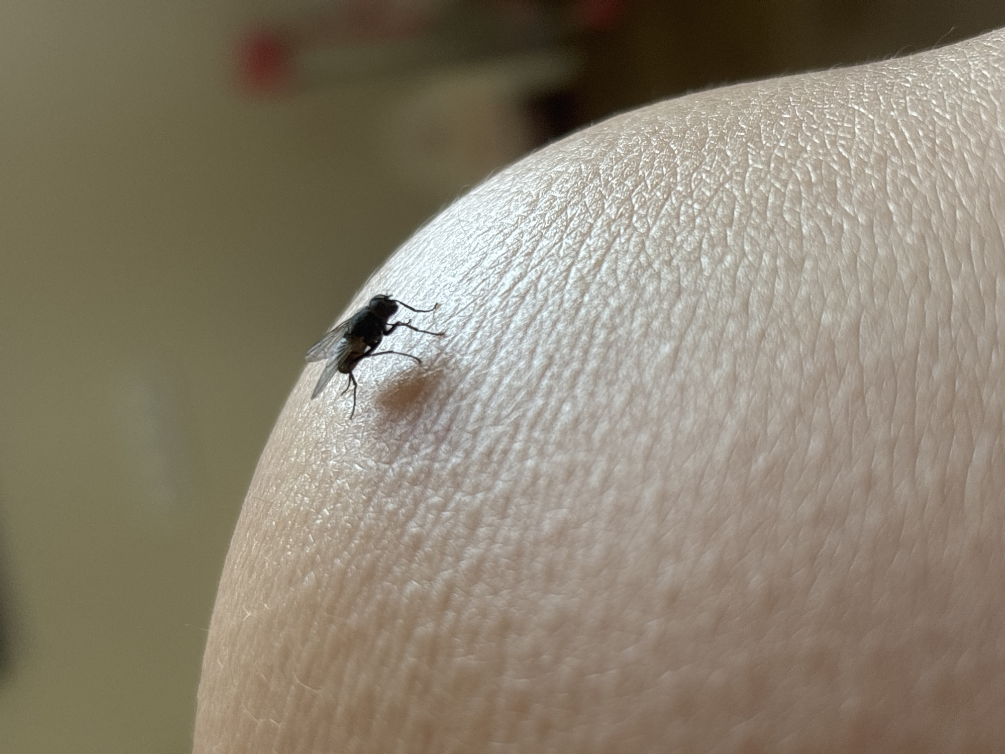 A fly is perched on the surface of human skin. The location is not identifiable.