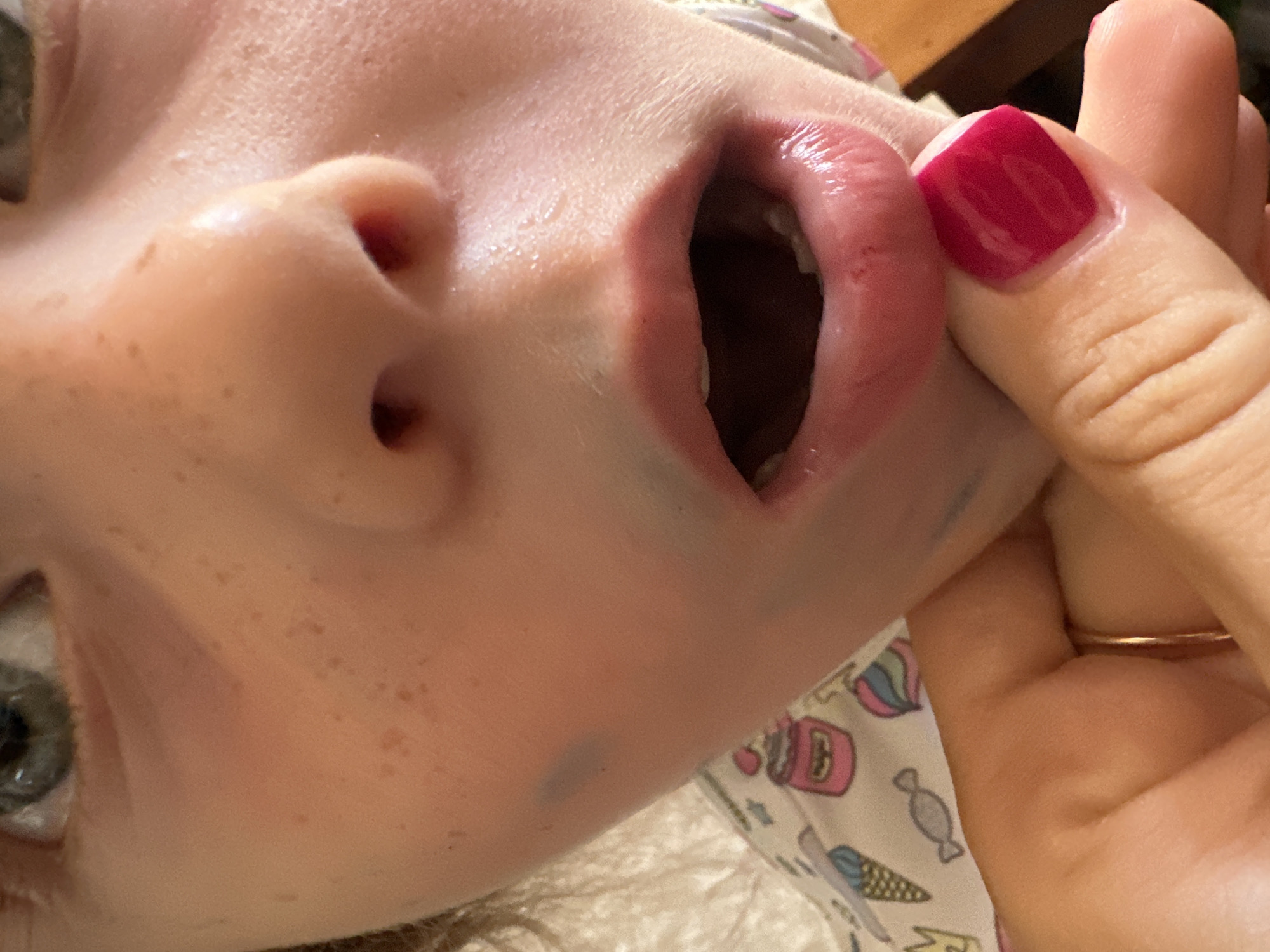 This is a close-up, rotated photograph of a young child's face. The child's mouth is open, revealing the inside of their mouth and some teeth. A person's finger, with bright pink nail polish, is holding the child's lip open. The child is wearing a patterned garment, possibly pajamas, with images of ice cream cones and candies. The background is blurred but suggests an indoor setting. The lighting appears to be natural, possibly from a window, and the overall tone of the image is intimate and personal, capturing a candid moment. The focus is on the child's mouth and the interaction with the adult's finger.