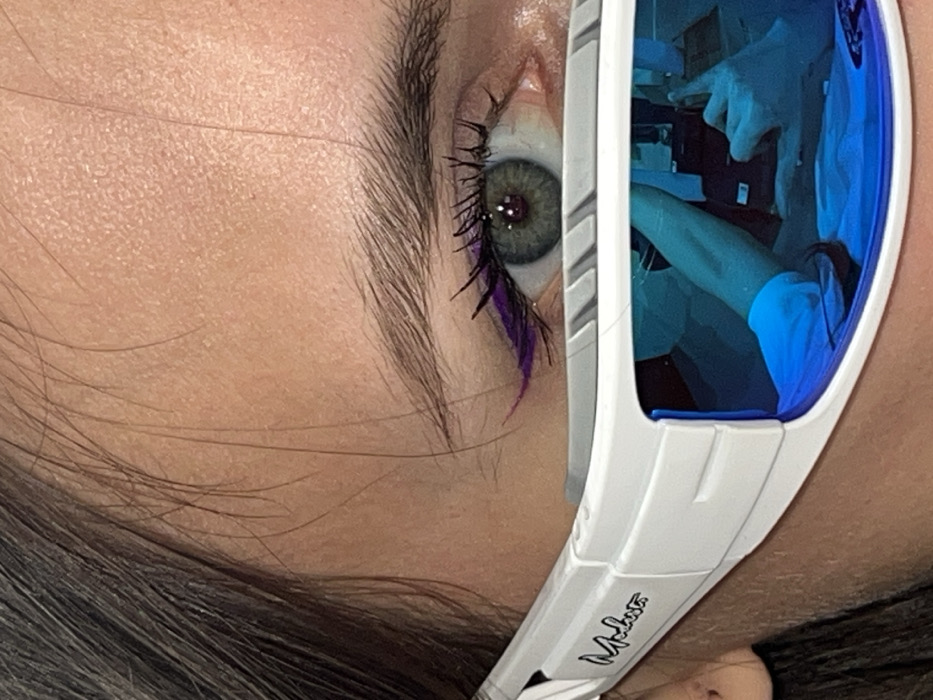 The image displays a close-up, high-angle view of the upper right portion of an individual's face, positioned in Krasnoyarsk, Russia. The central focus is a grey-green eye with a dilated pupil, exhibiting a distinct light reflection. A prominent purple winged eyeliner is applied to the upper eyelid, enhanced by dark mascara on the eyelashes. The individual's dark eyebrow is visible above the eye, with a section of the forehead and temple also within the frame. White, sports-style sunglasses, bearing the brand name "Molusta" on the temple, are worn with their upper frame situated horizontally just below the eye. These sunglasses feature blue mirrored lenses. The right lens of the sunglasses clearly reflects a second individual, who is actively taking a photograph. This reflected individual is observed wearing a light-colored, long-sleeved garment and is holding a dark camera device with both hands, aimed towards the subject. The reflected background behind the photographer is indistinct.
